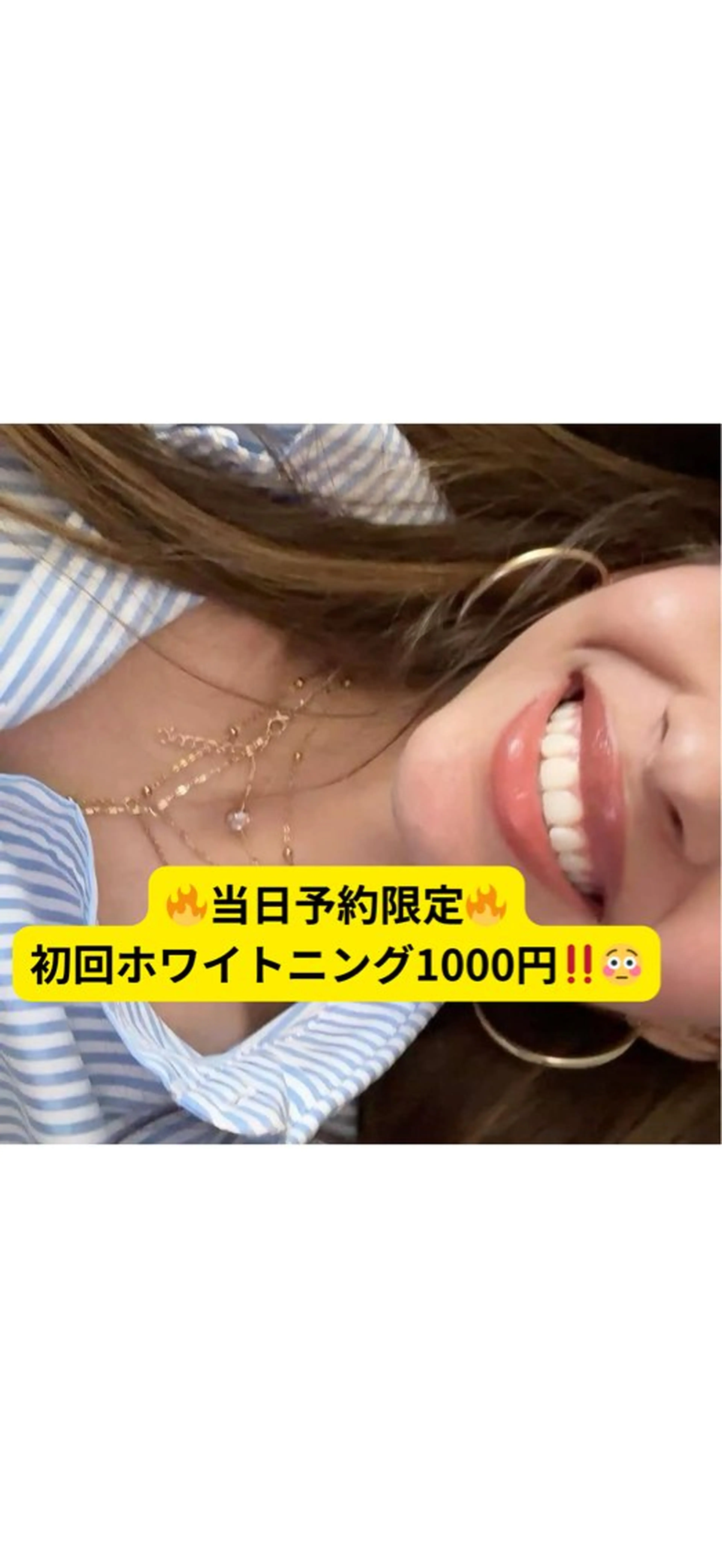 その他 LIBRA自由が丘所属・LIBRA自由が丘 ホワイトニングのその他イメージ