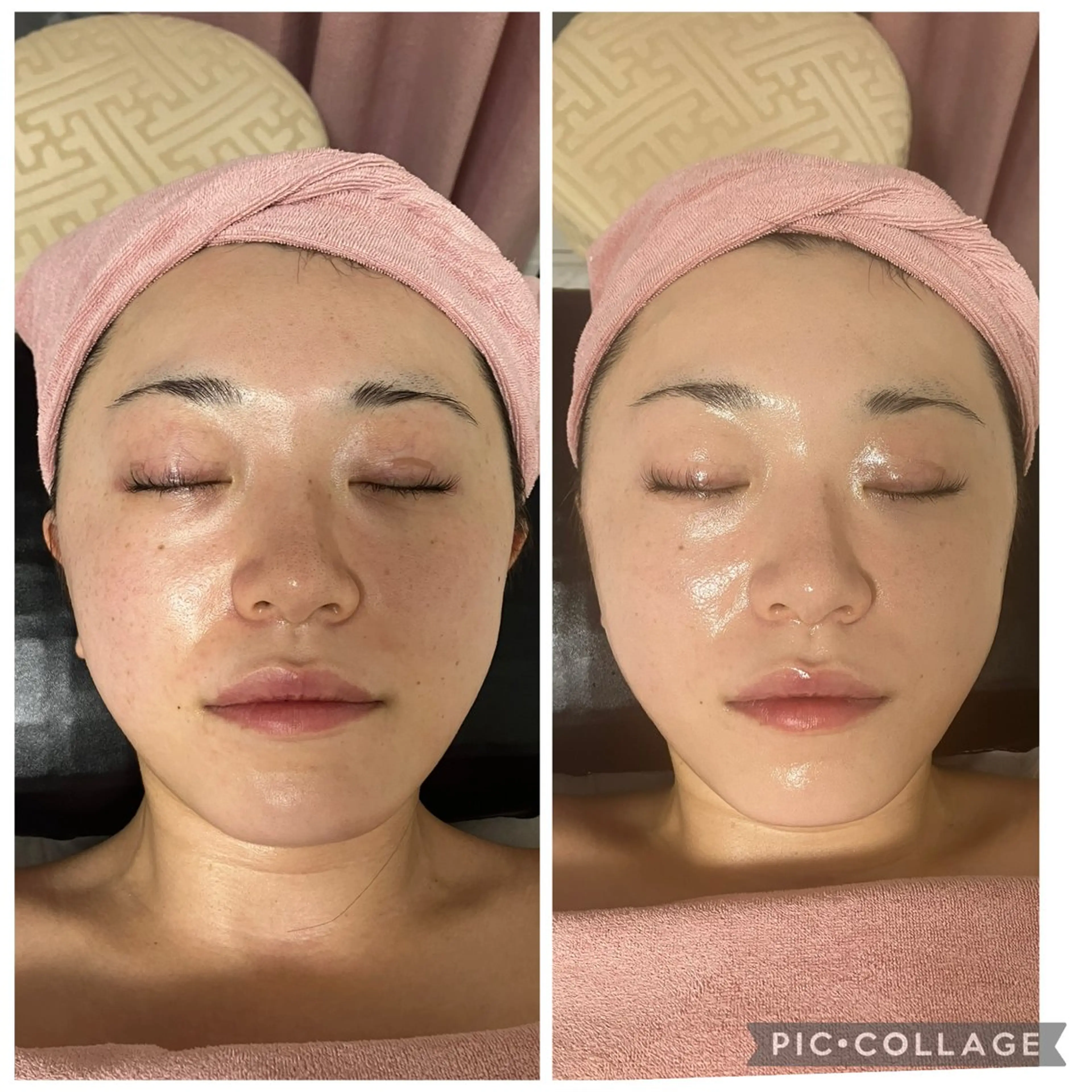 メディカルエステ　痩身·小顔専門サロンBBC 田園調布所属・KEI KOのエステ・リラクイメージ