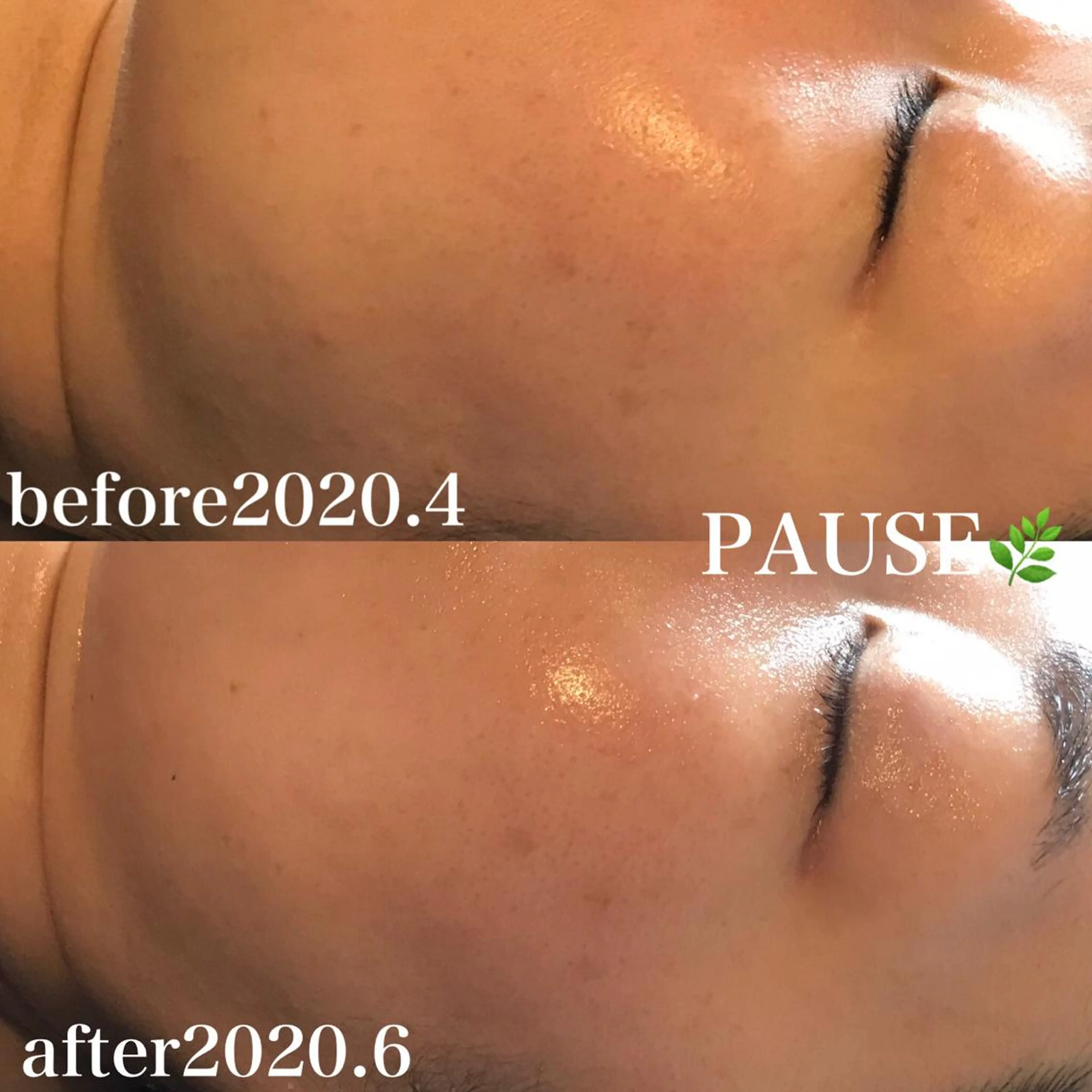 エステ 浜野 恵美のエステ・リラクイメージ