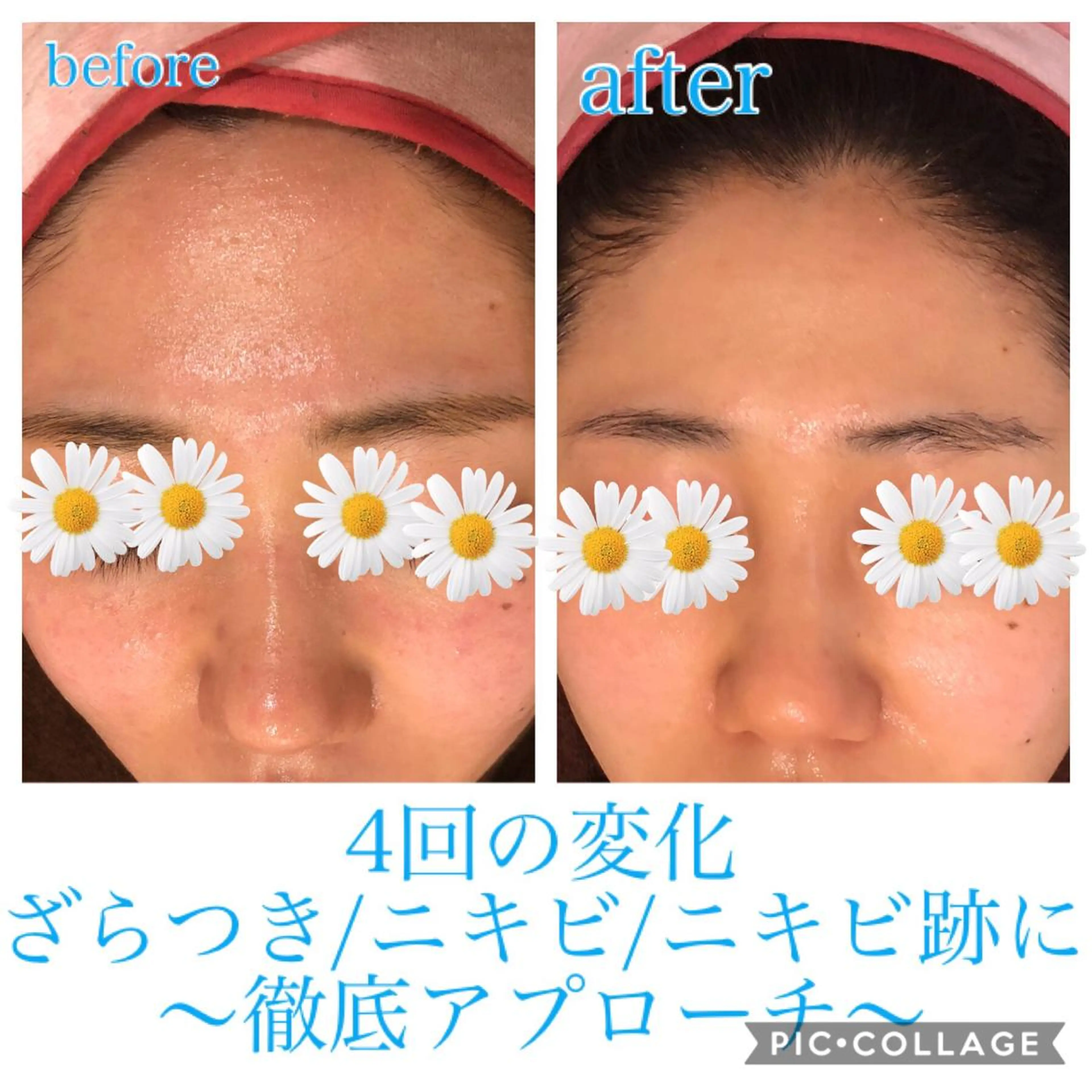 ロング カラー パーマ ヘアアレンジ キッズ ネイル マツエク・マツパ エステ リラク EnsorClair 代表 野口真央のエステ・リラクイメージ