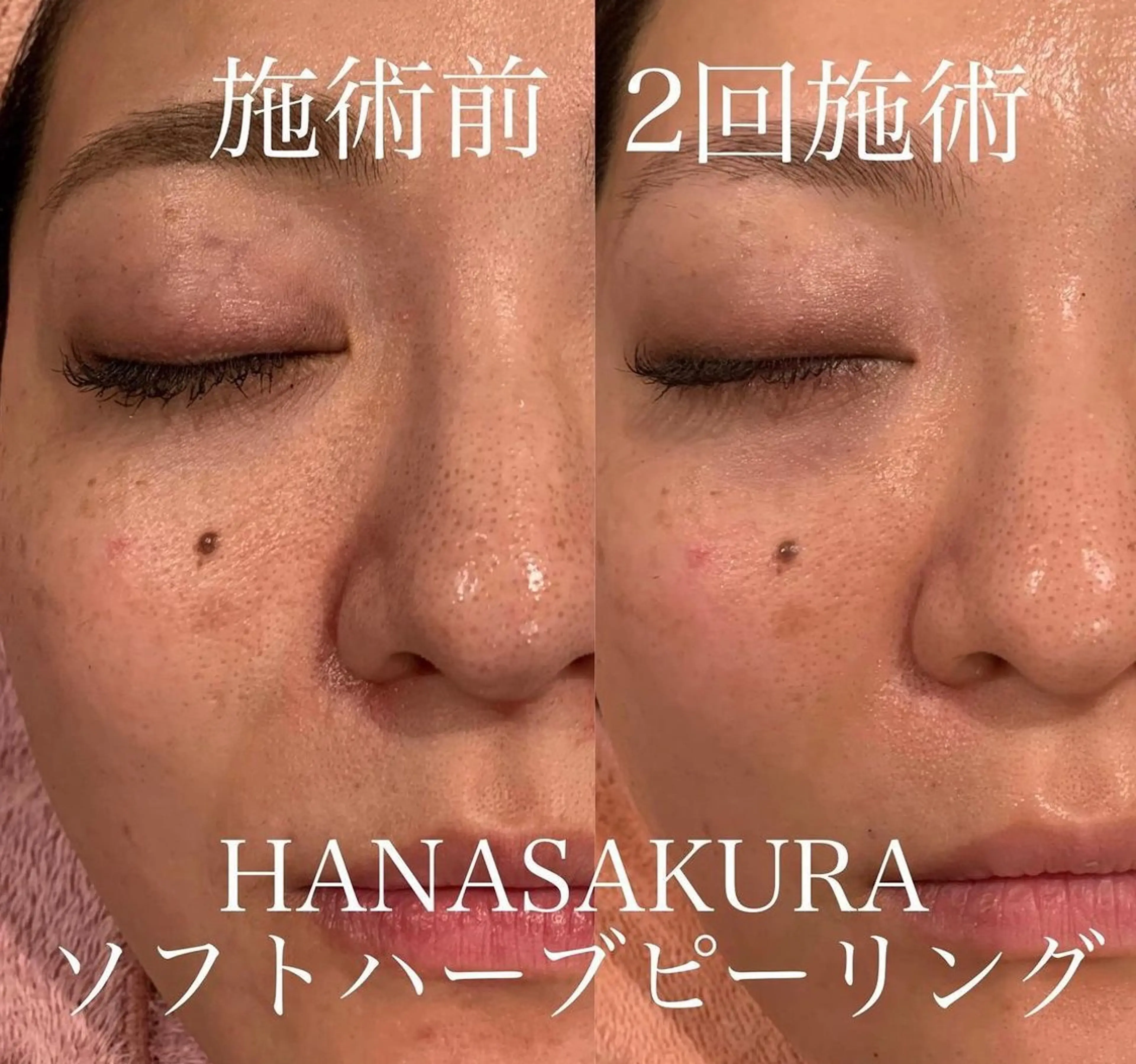 HANASAKURA 心斎橋のエステ・リラクイメージ