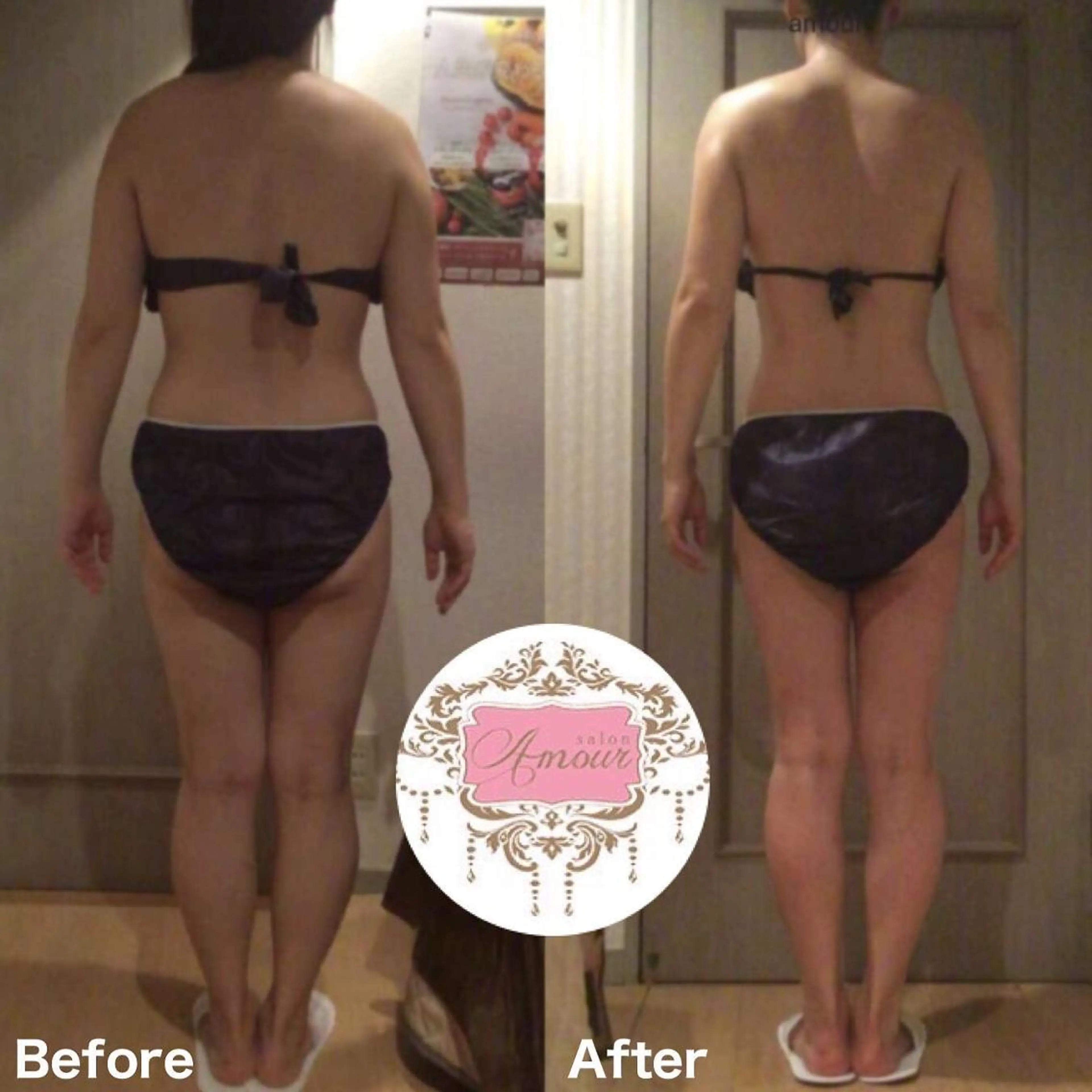 💎大人気💎特殊な吸引とローラでセルライト分解していきながら凝りも解消70分2回券🫶の写真