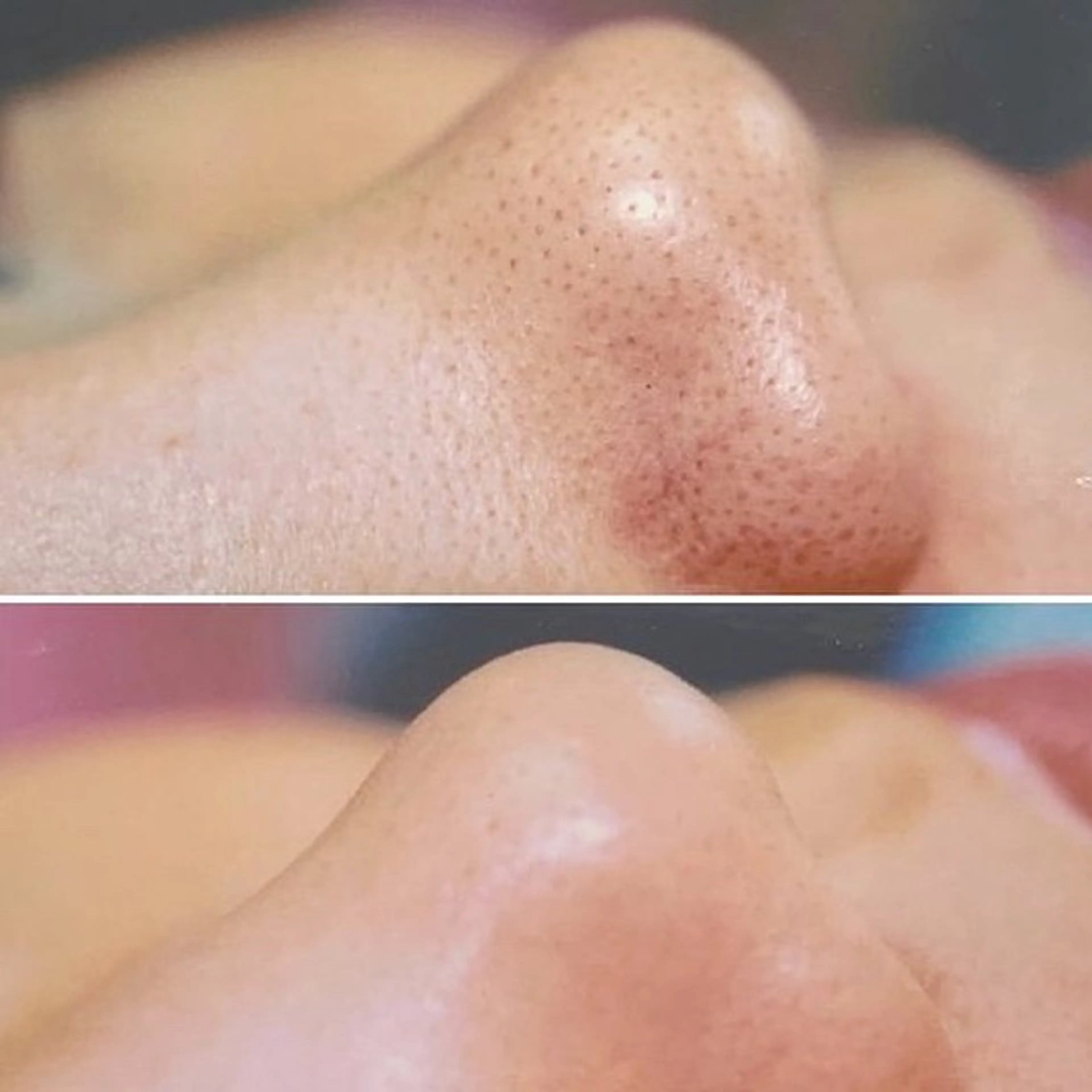 Balance facialのエステ・リラクイメージ