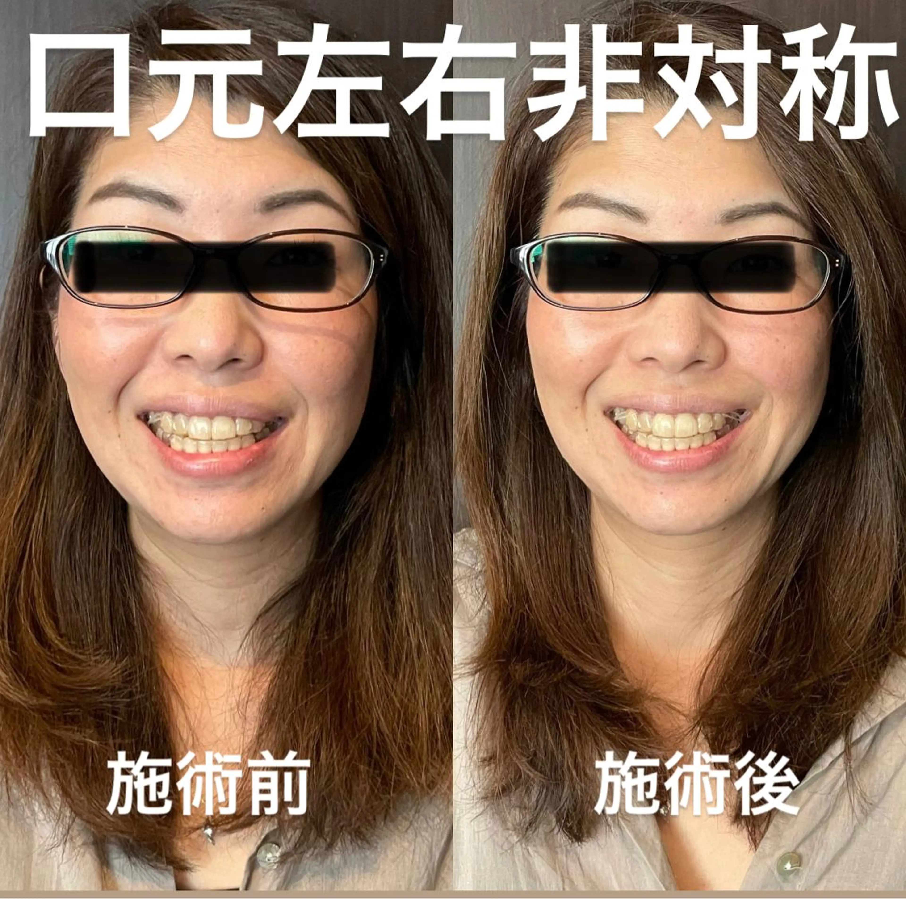 その他 マッツンの 鍼のその他イメージ