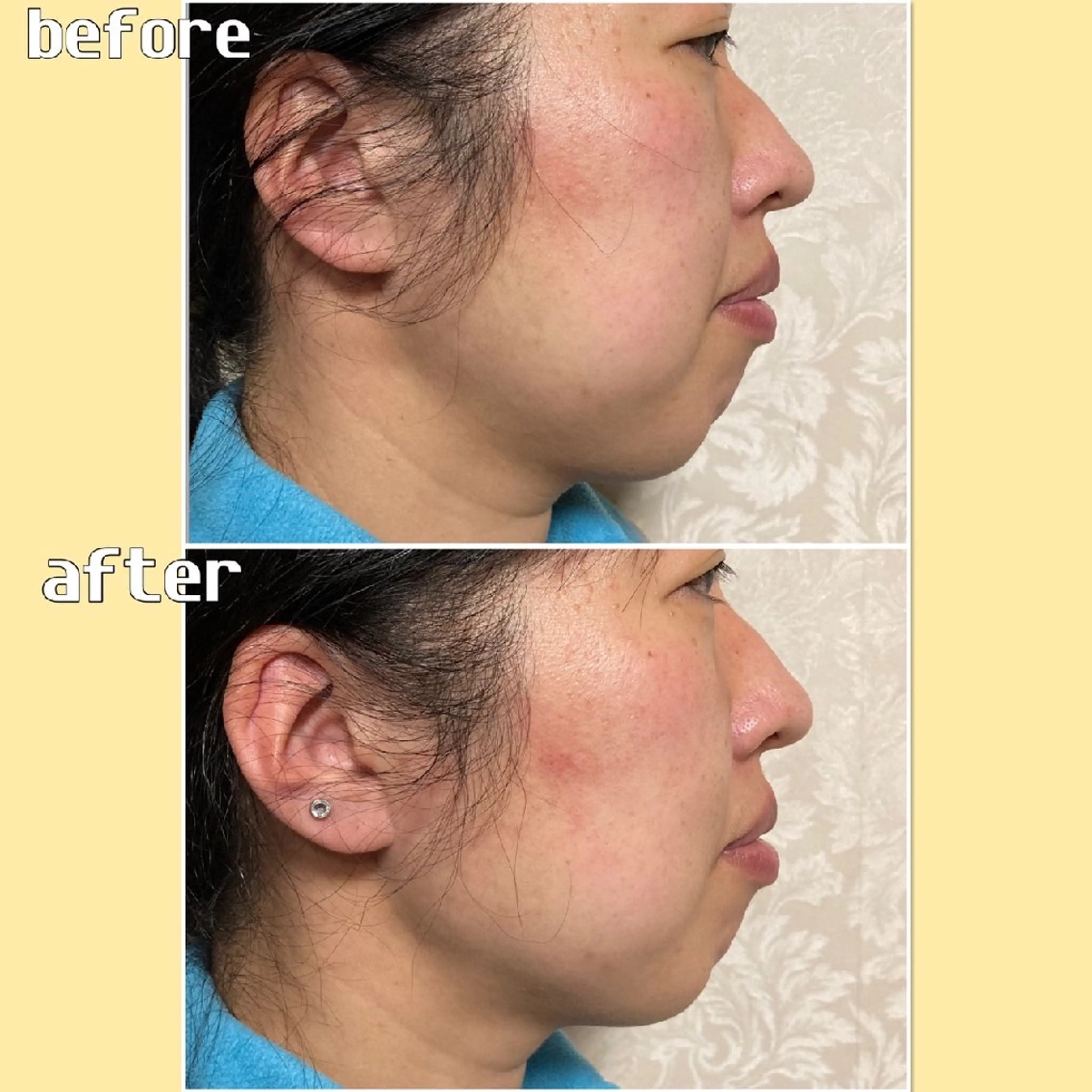 vi roots所属・vi rootsのエステ・リラクイメージ