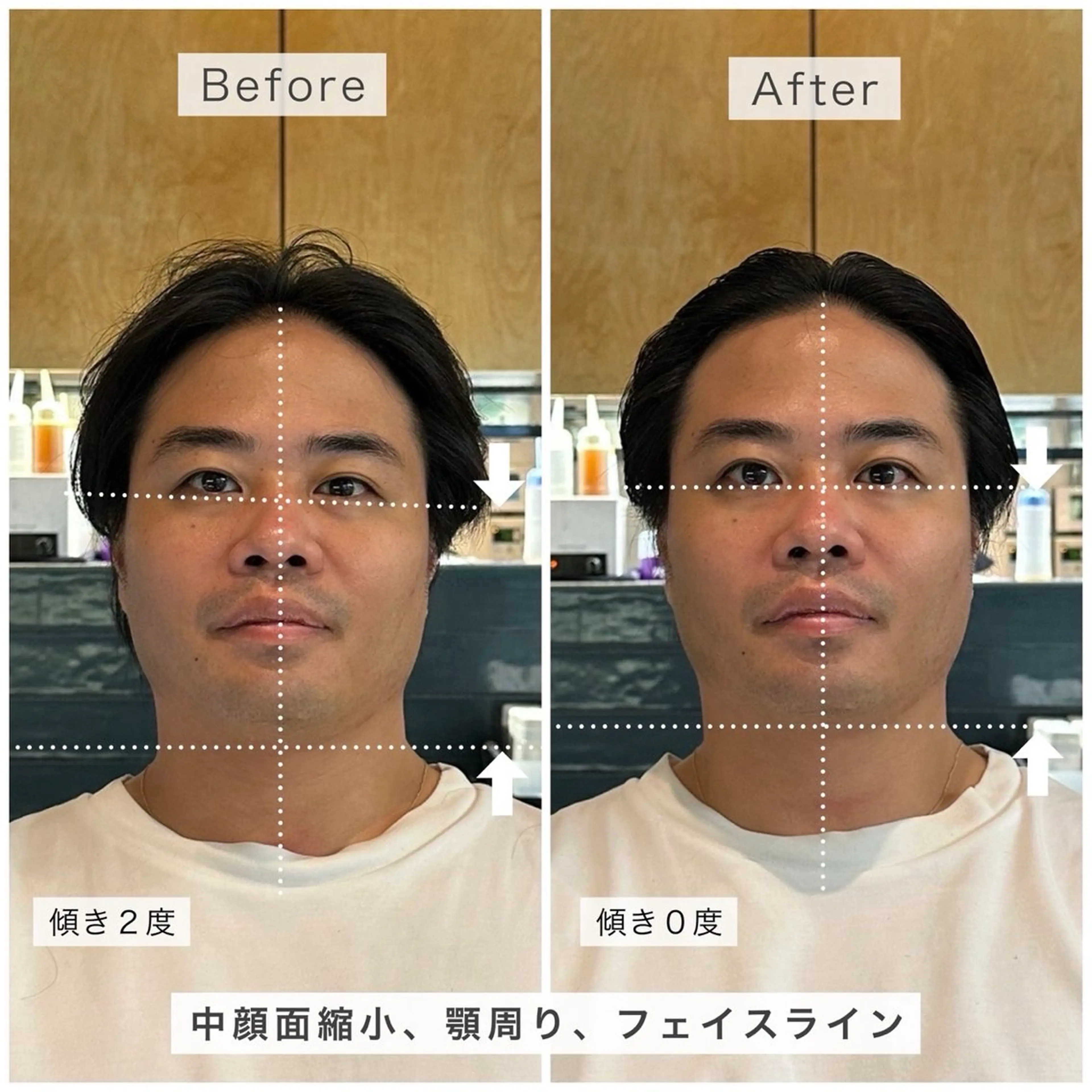 ととのう小顔 骨格補正スパ💆🏻‍♀️🫧 ※S.B込みの写真