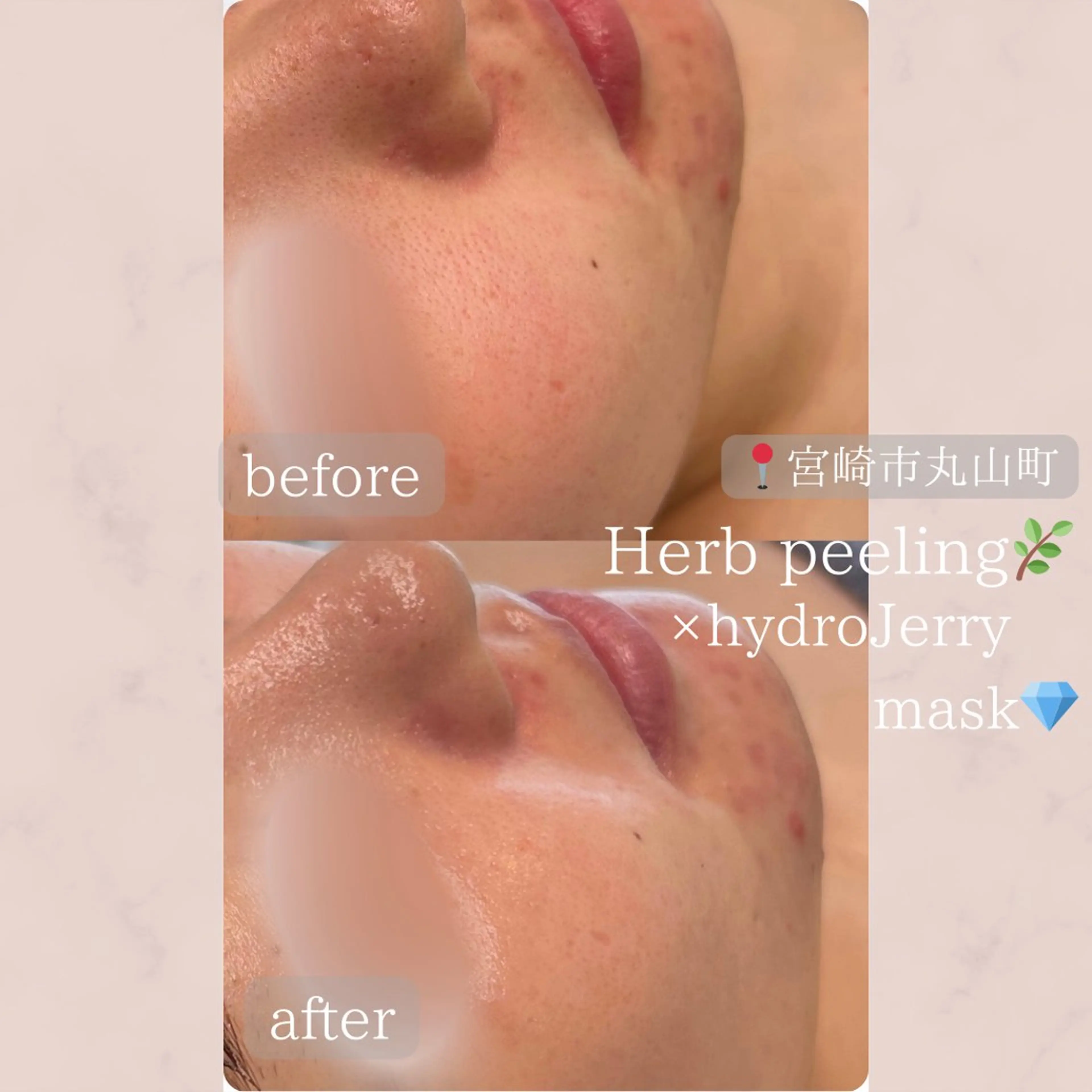 Le cherienのエステ・リラクイメージ