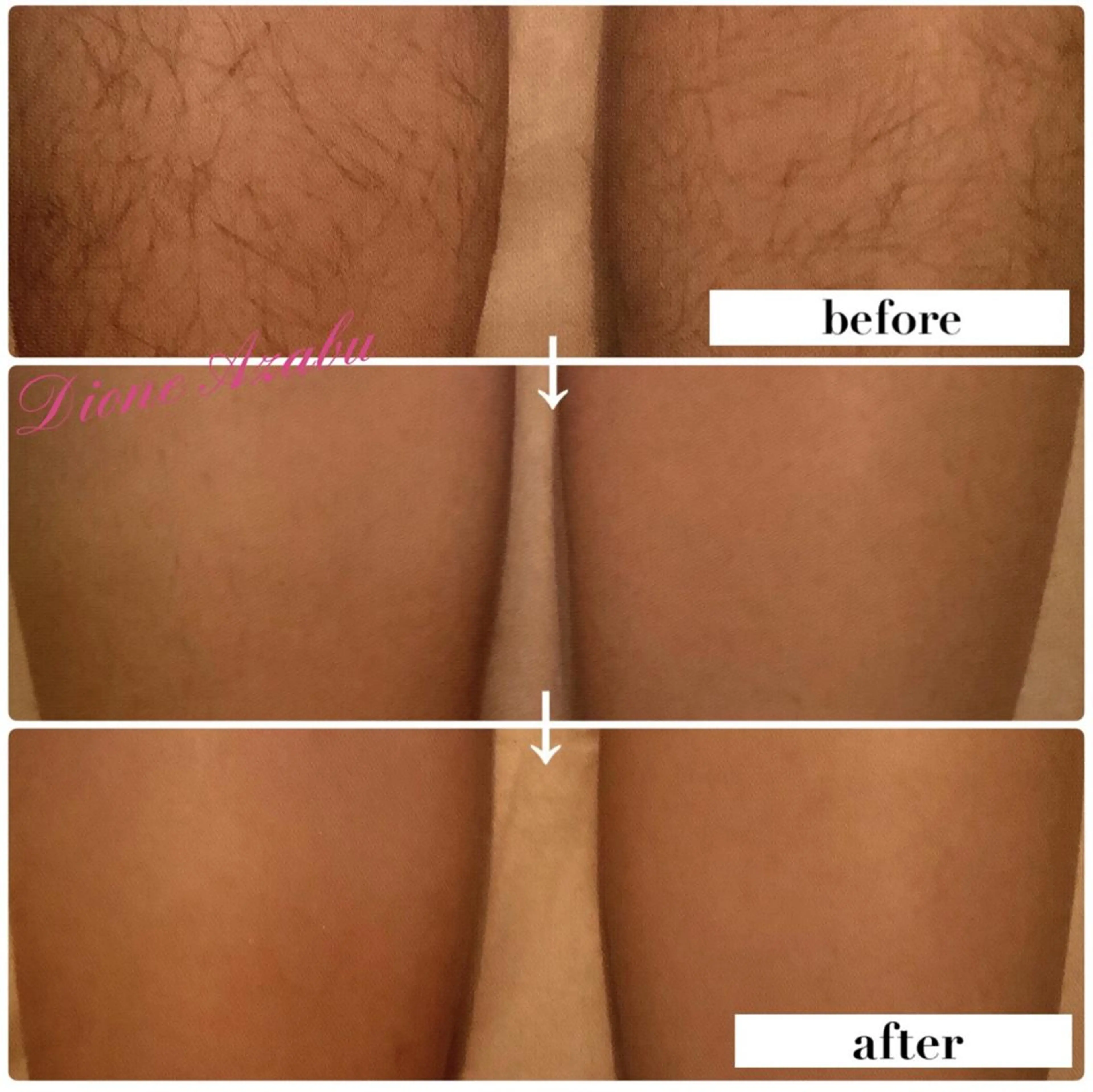 DIONE 麻布十番店のエステ・リラクイメージ