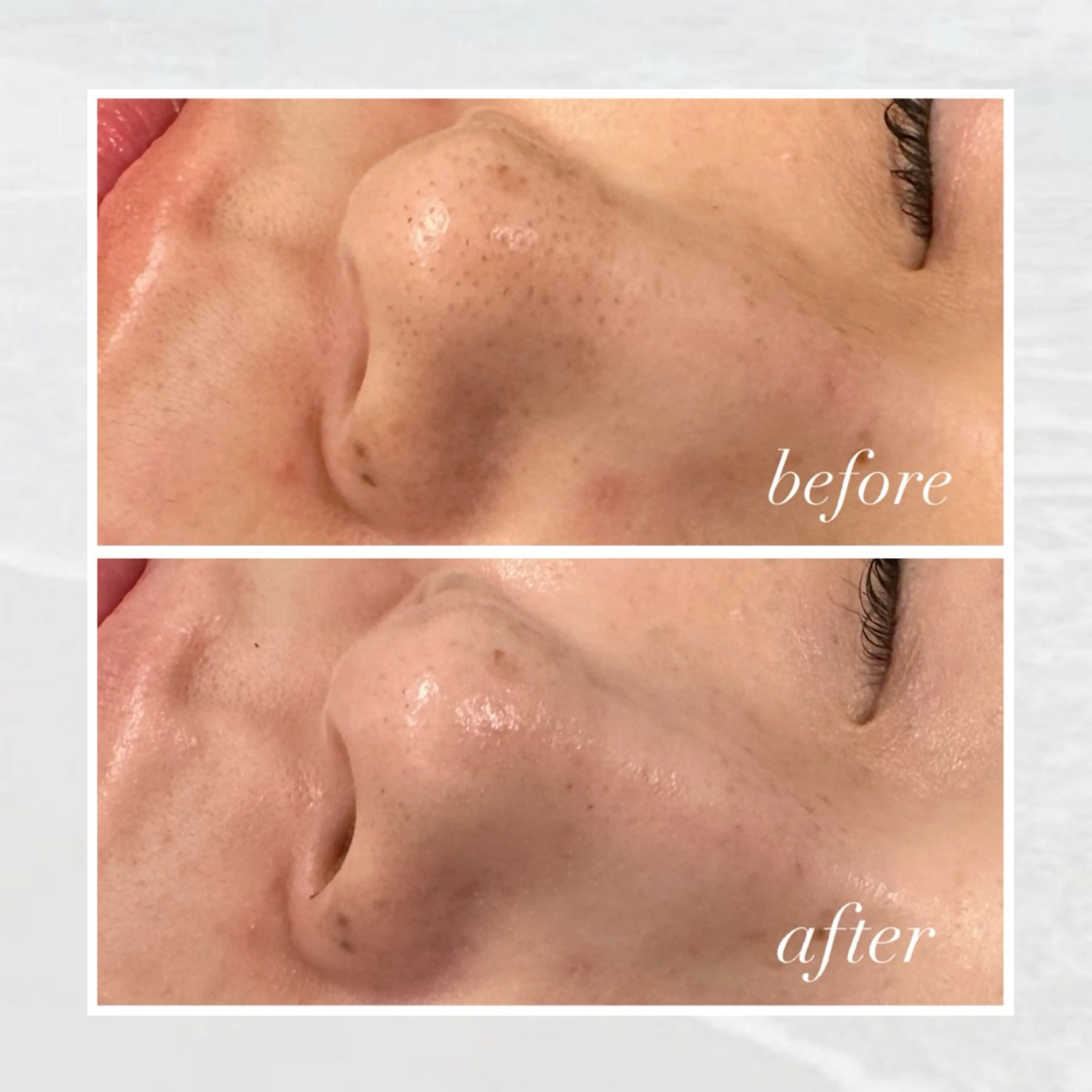 エステ 🦋美肌サロン. maho🦋のエステ・リラクイメージ