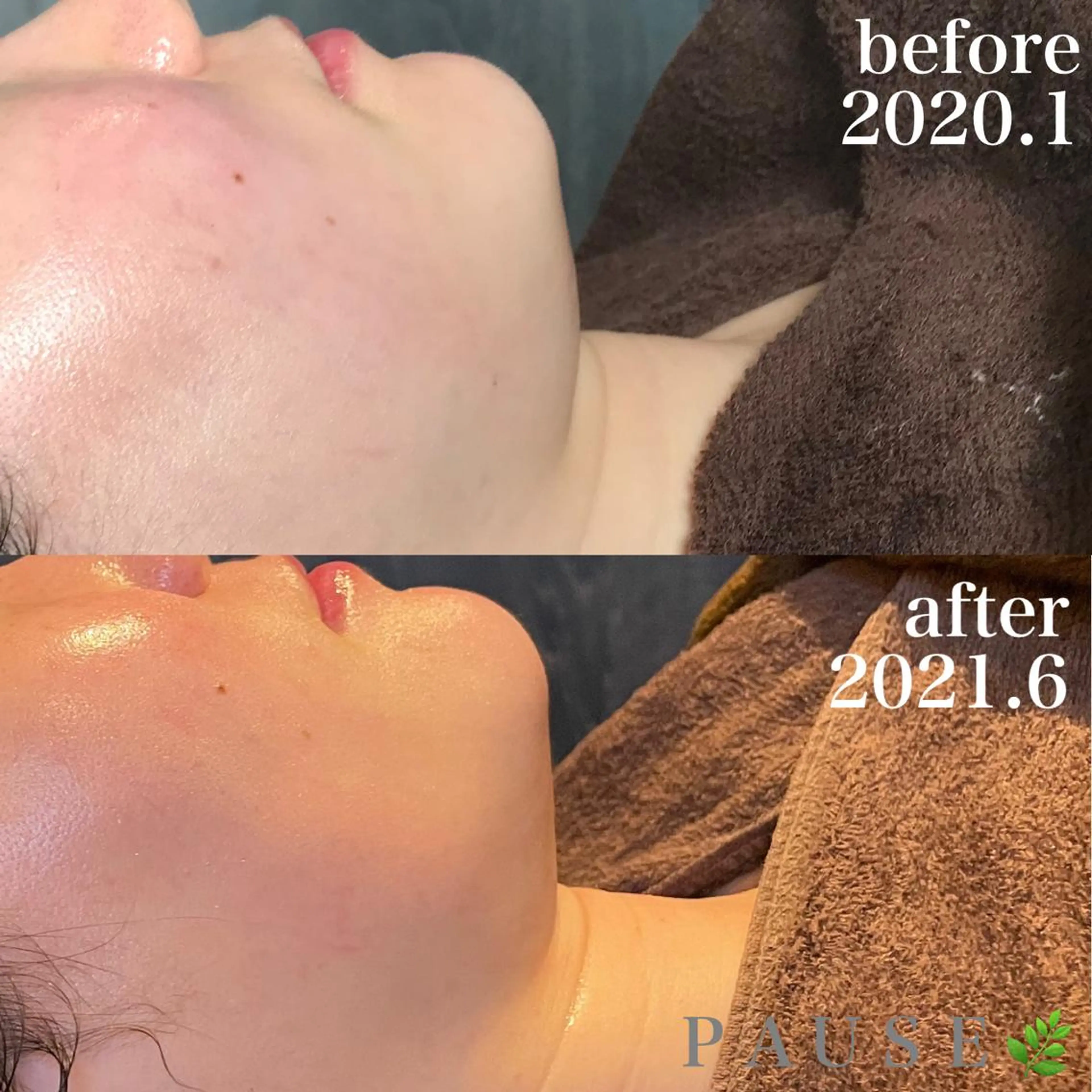 エステ 浜野 恵美のエステ・リラクイメージ