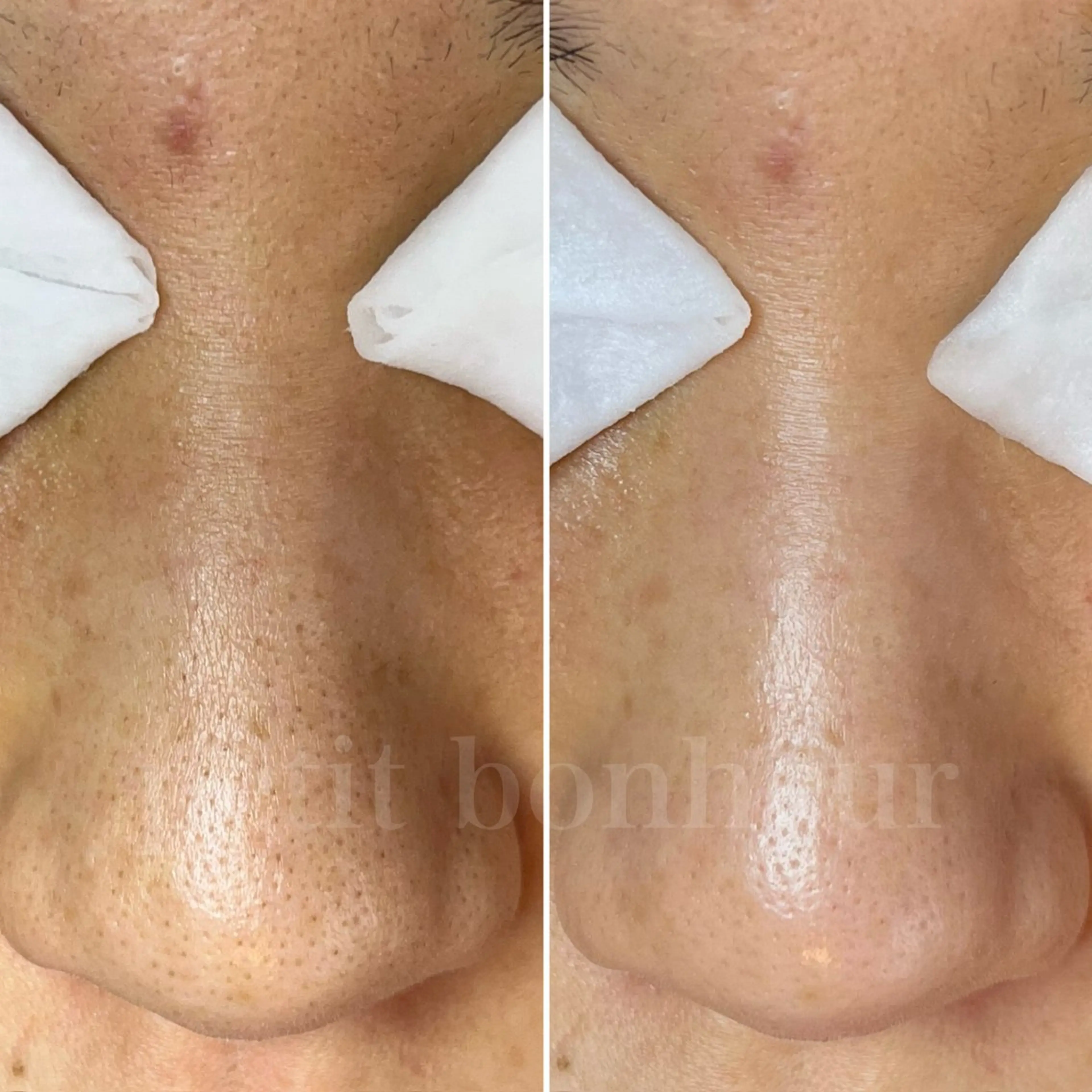 エステ 槙谷 あさみのエステ・リラクイメージ