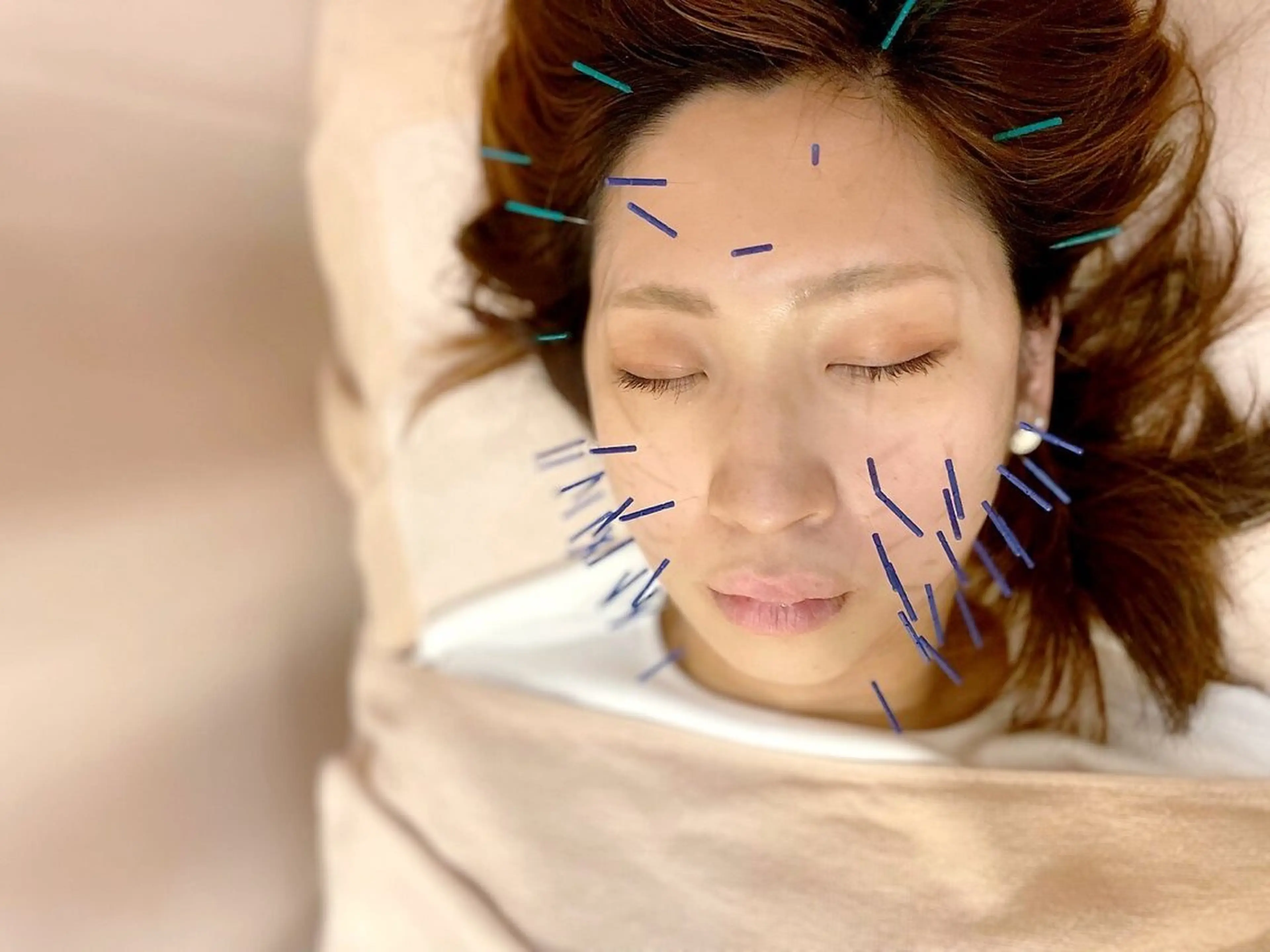 こじま富雄団地 接骨院のその他イメージ