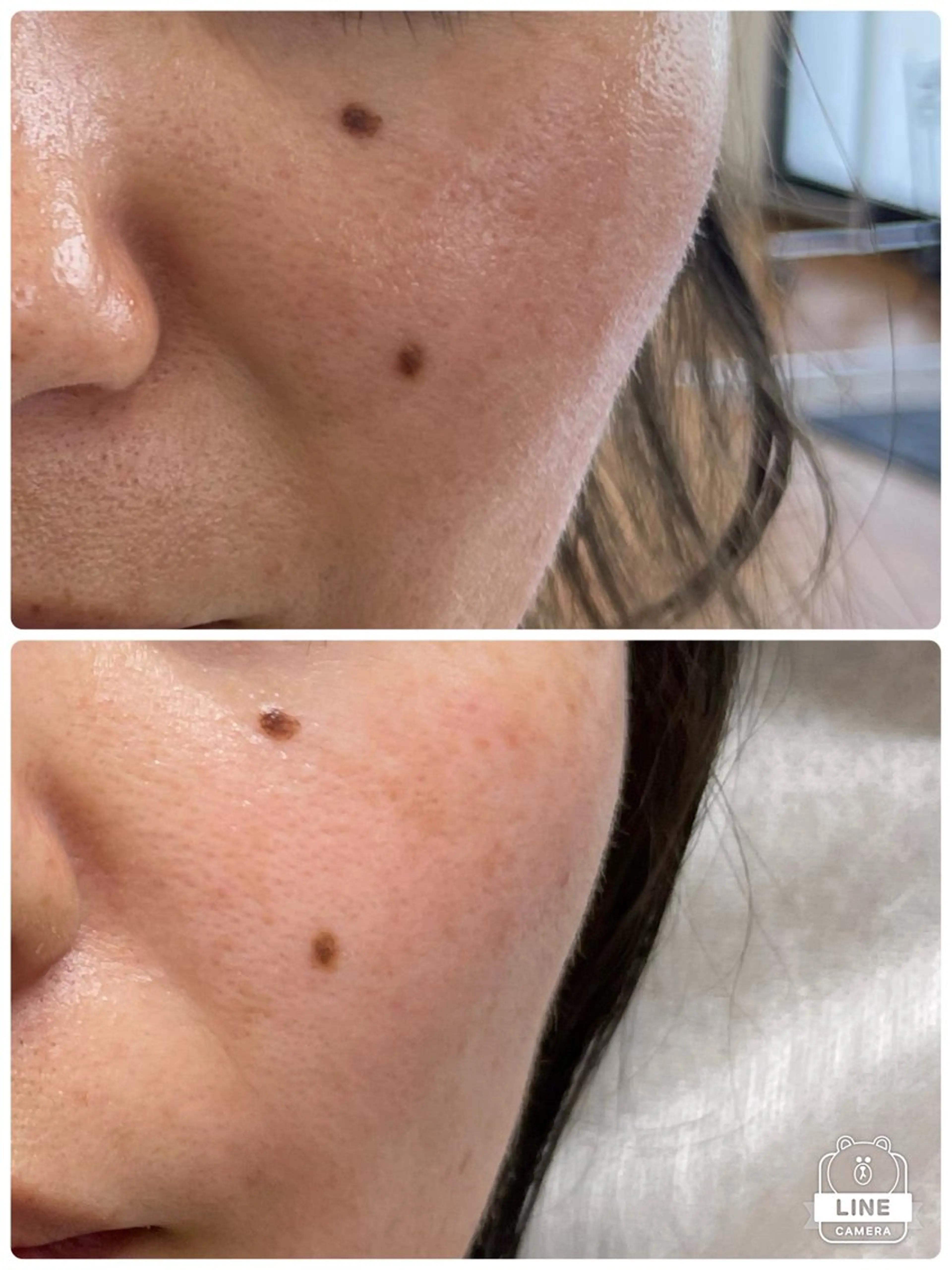 デアイム甲府所属・つかだ りょうこのエステ・リラクイメージ