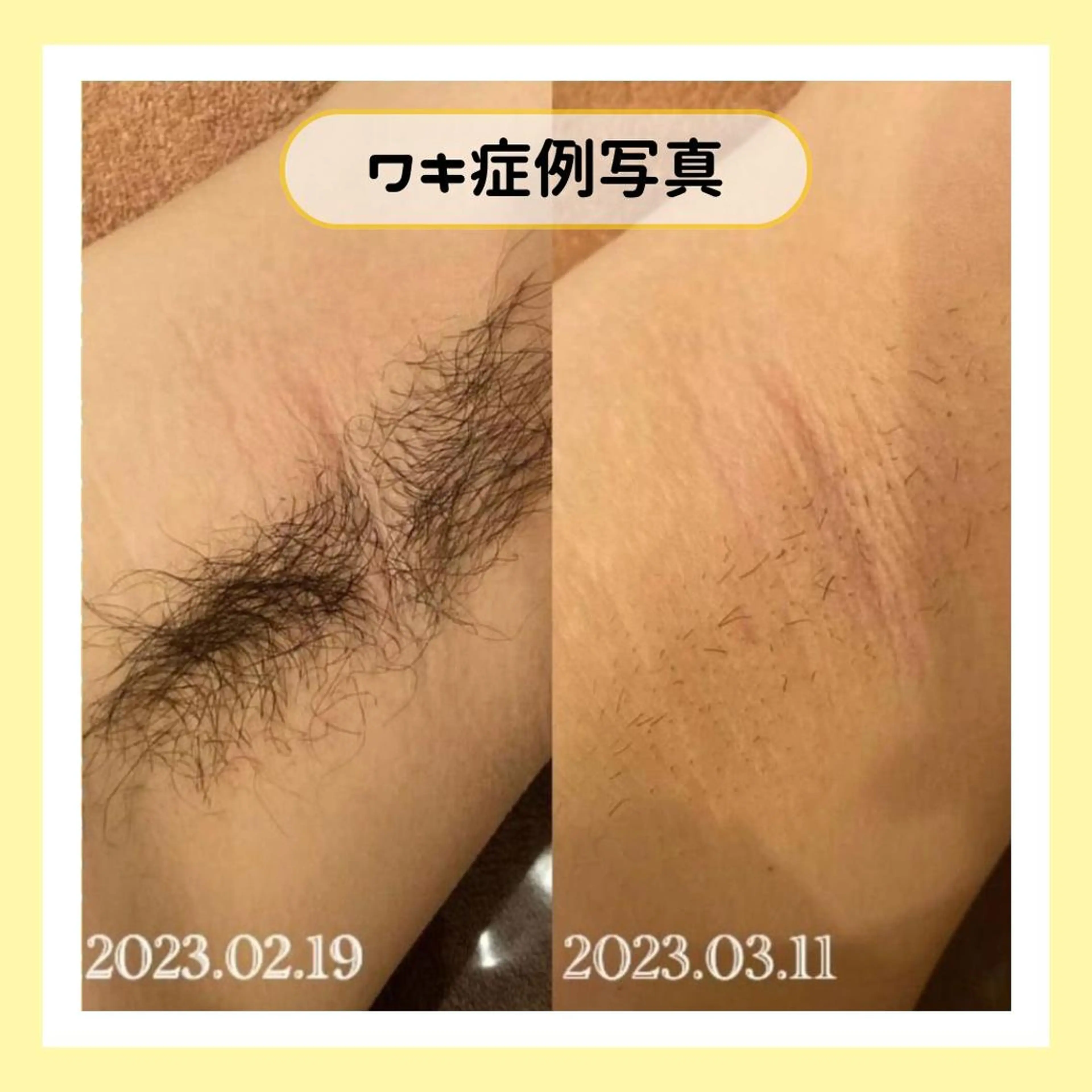 金山/脱毛/美肌 ULULUのエステ・リラクイメージ