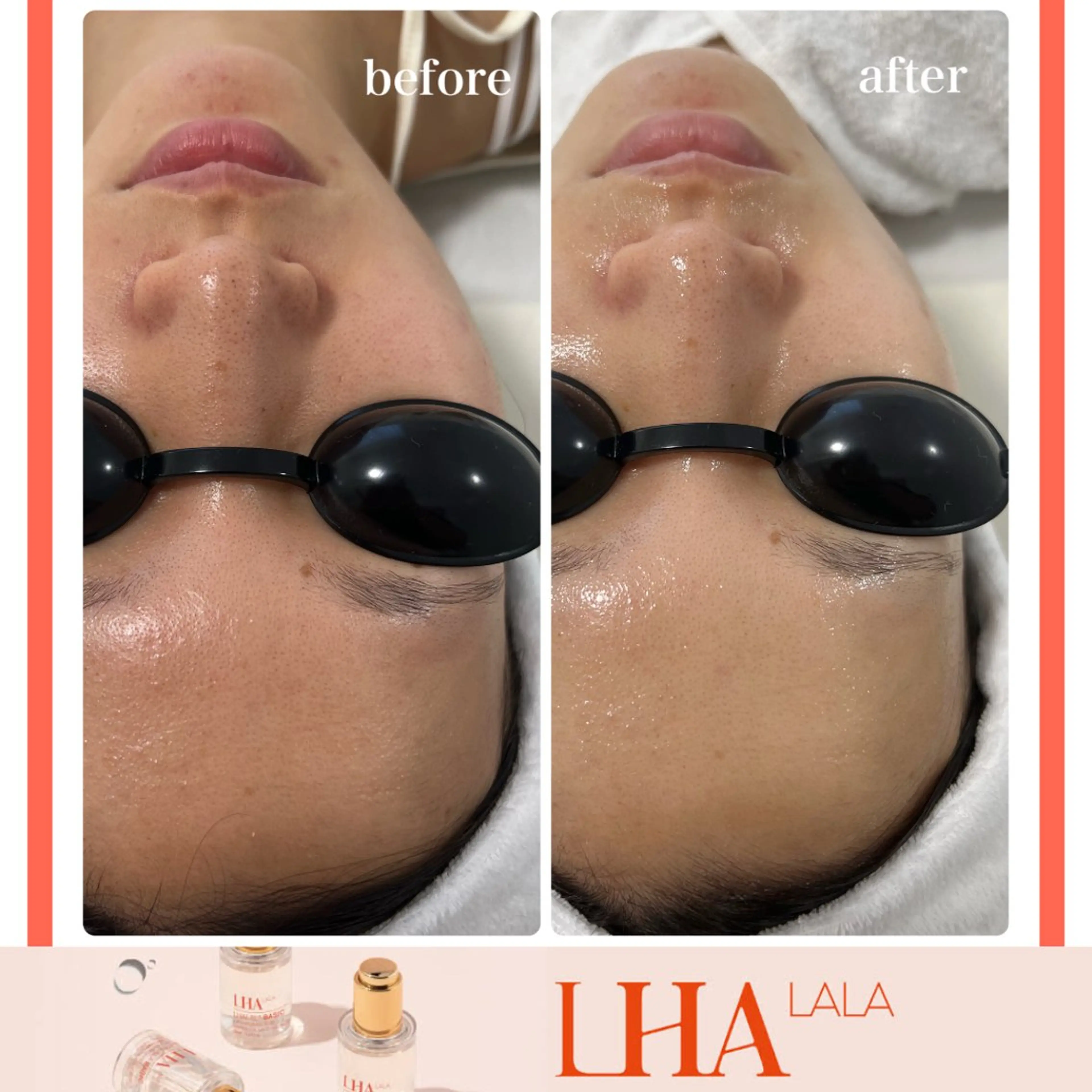 LiAm《美肌管理/ 小顔/脂肪ケア》のその他イメージ