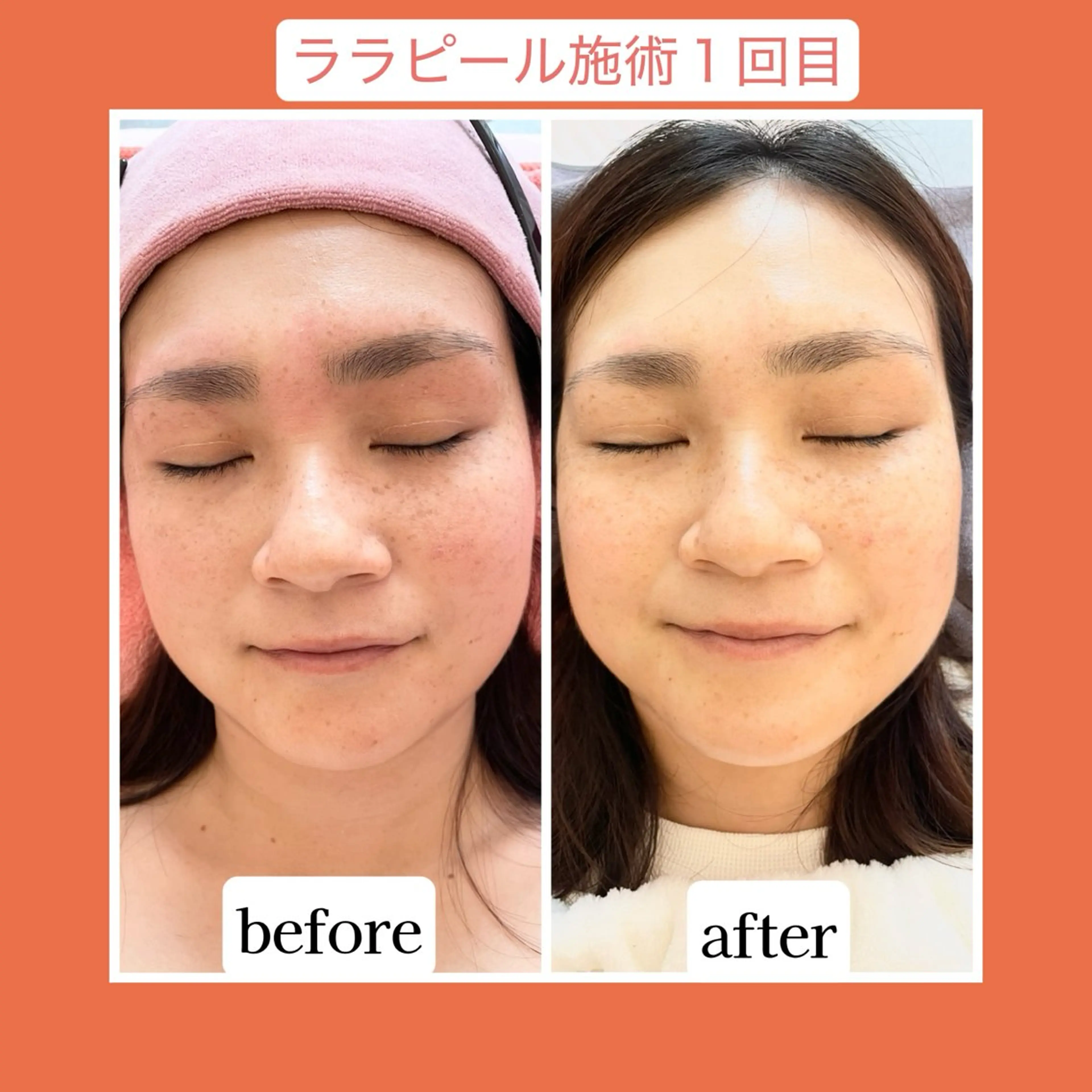 💜Karen PrivateSpaのエステ・リラクイメージ