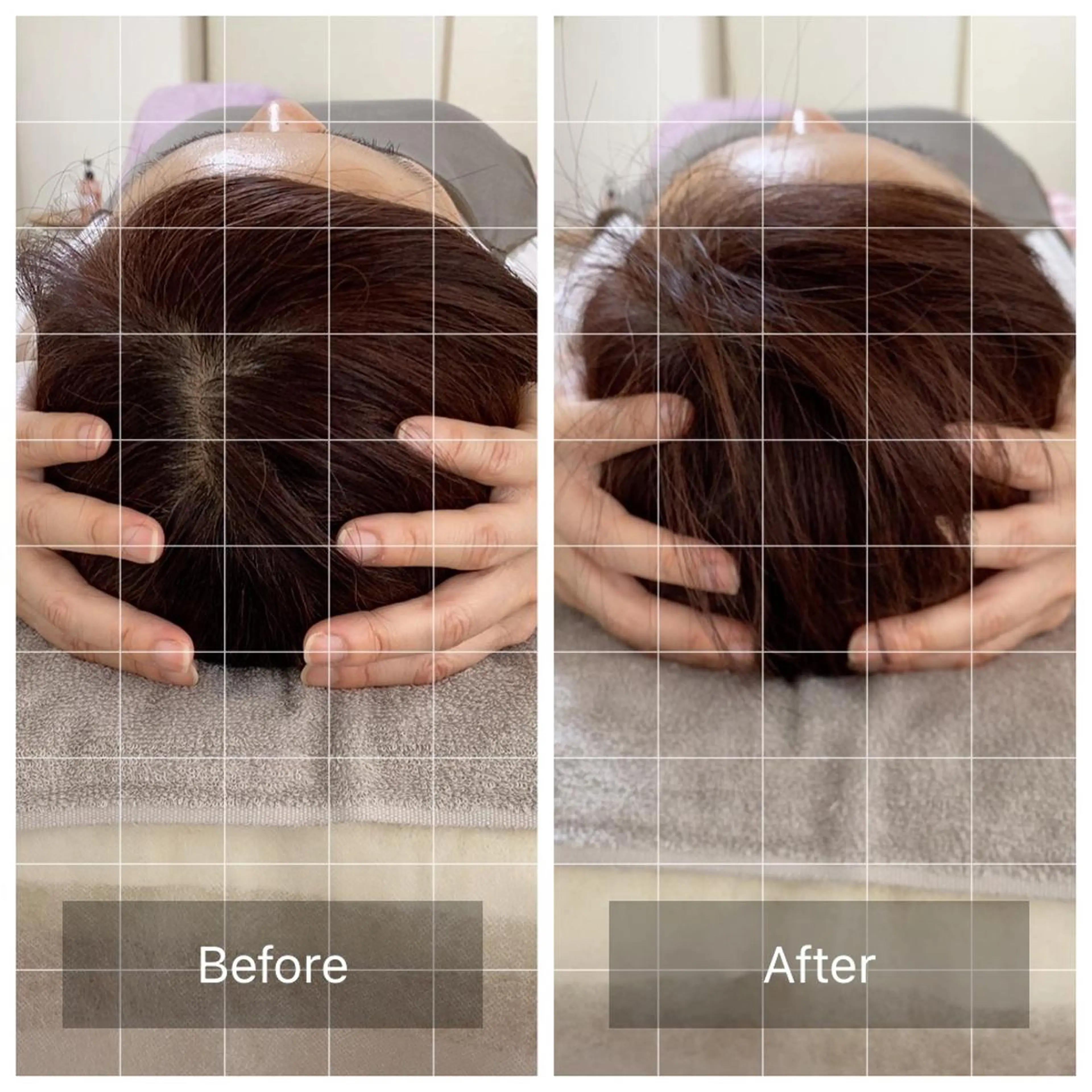 今話題の脳洗浄🌈頭の浮腫を取り除きます！下記料金は通常料金です。モニター価格にて予約の受付開始しております✨の写真