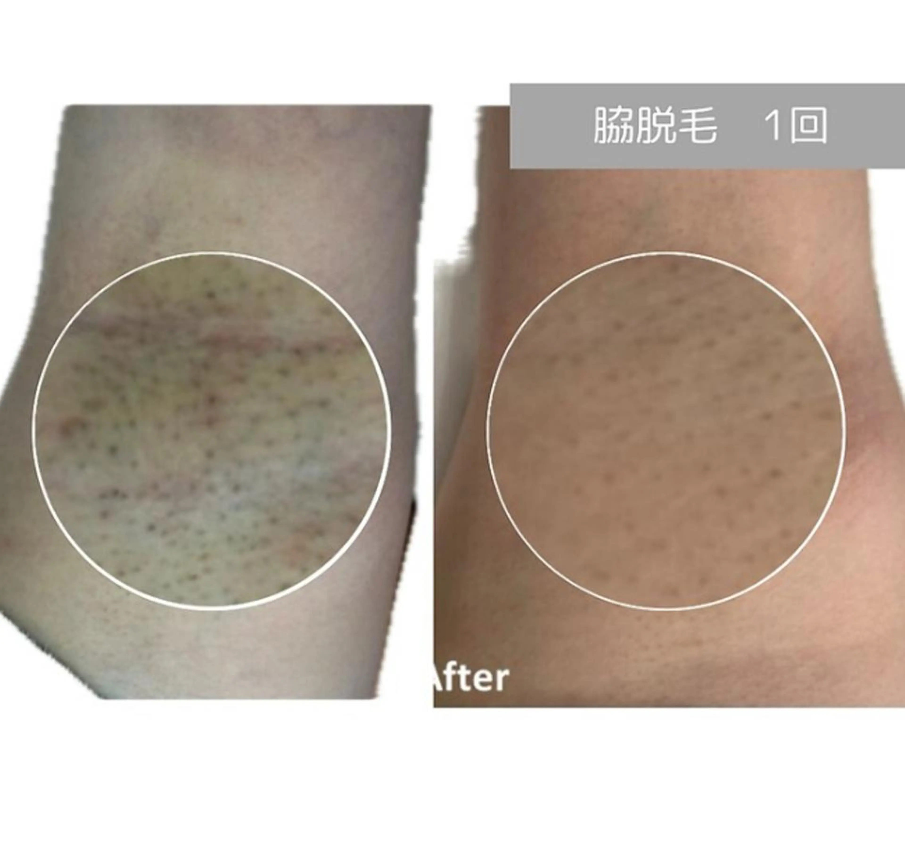 脱毛 Adam Umiのエステ・リラクイメージ