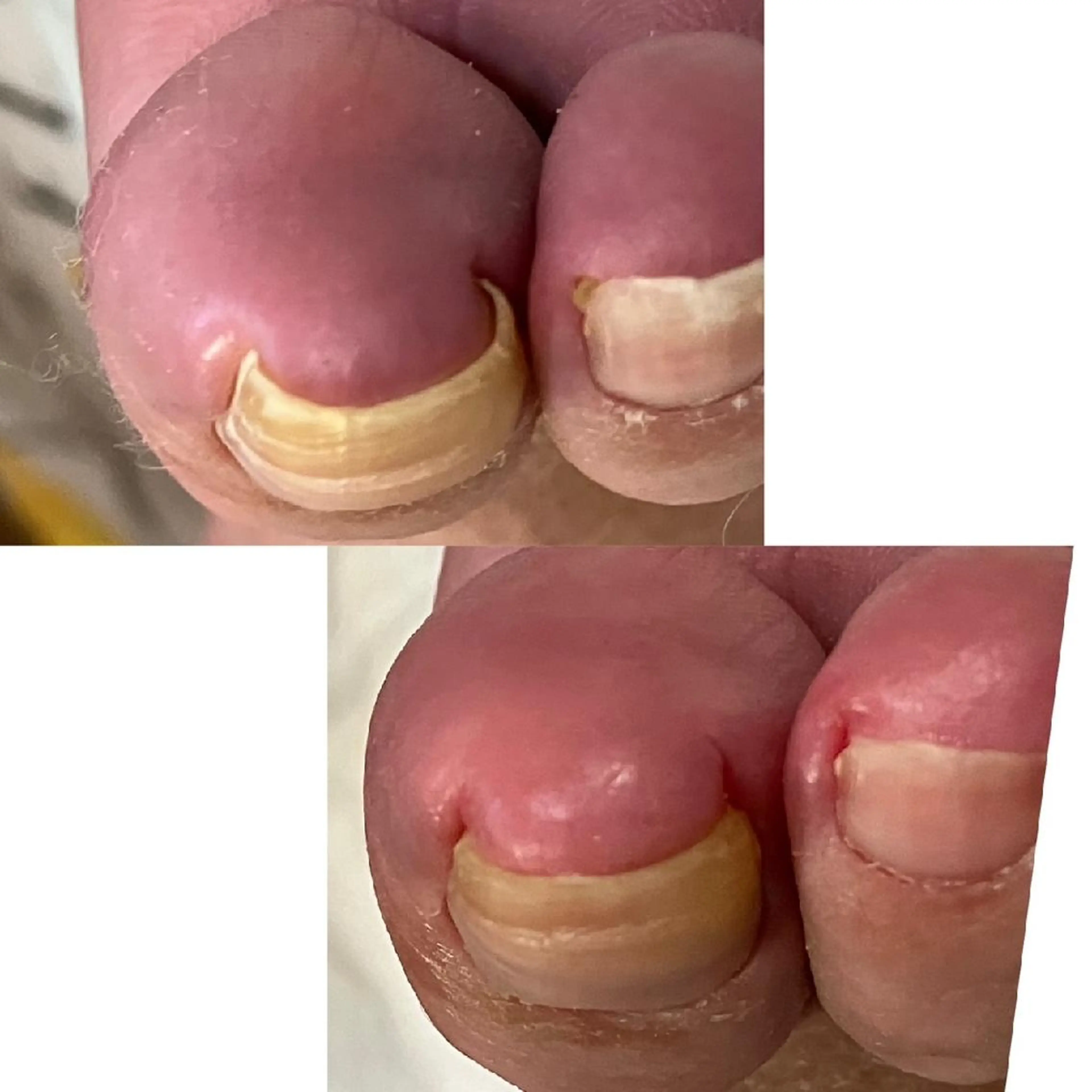 その他 carenail　 tsugumiのその他イメージ