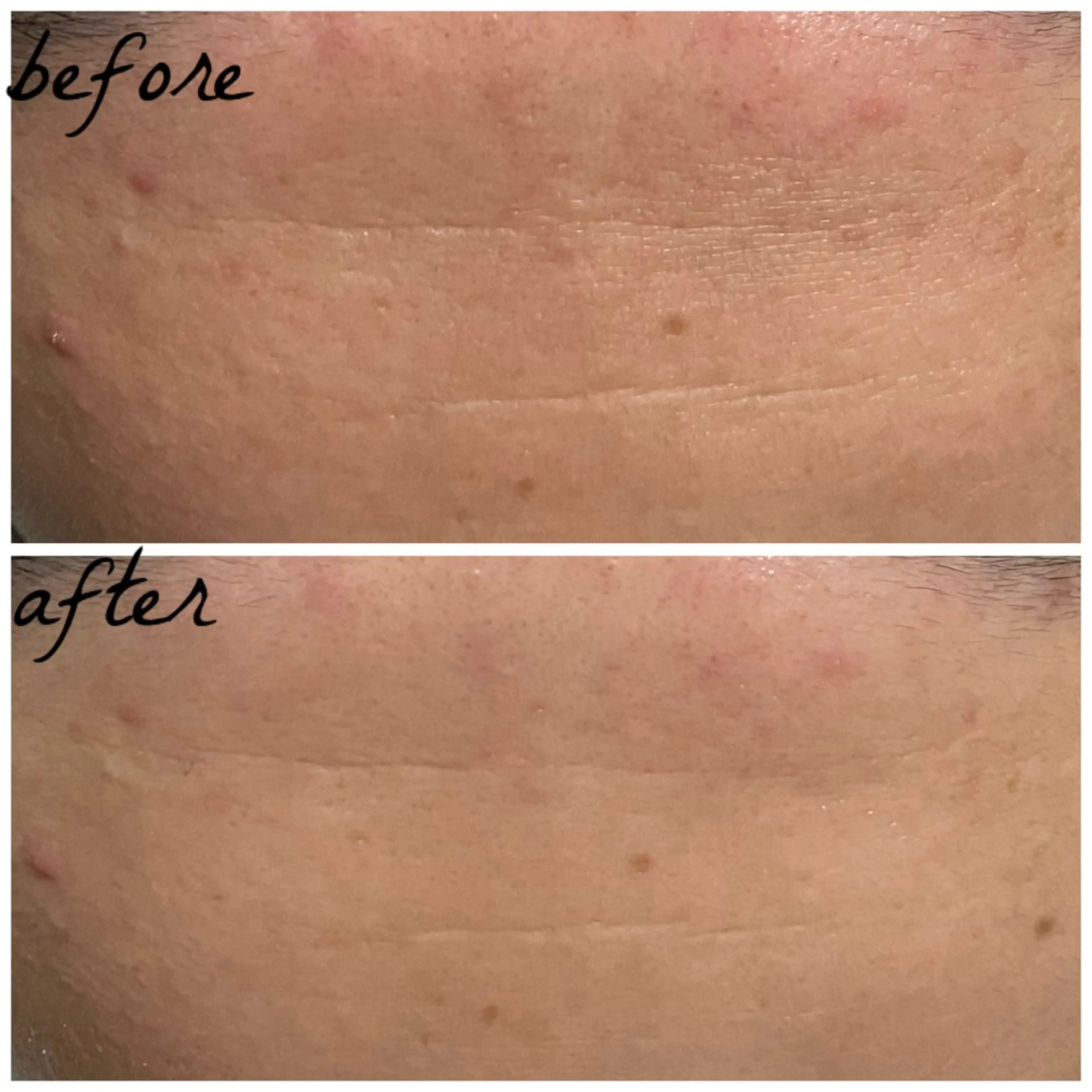 メンズ エステ メナード岐阜茜部 杉浦のエステ・リラクイメージ