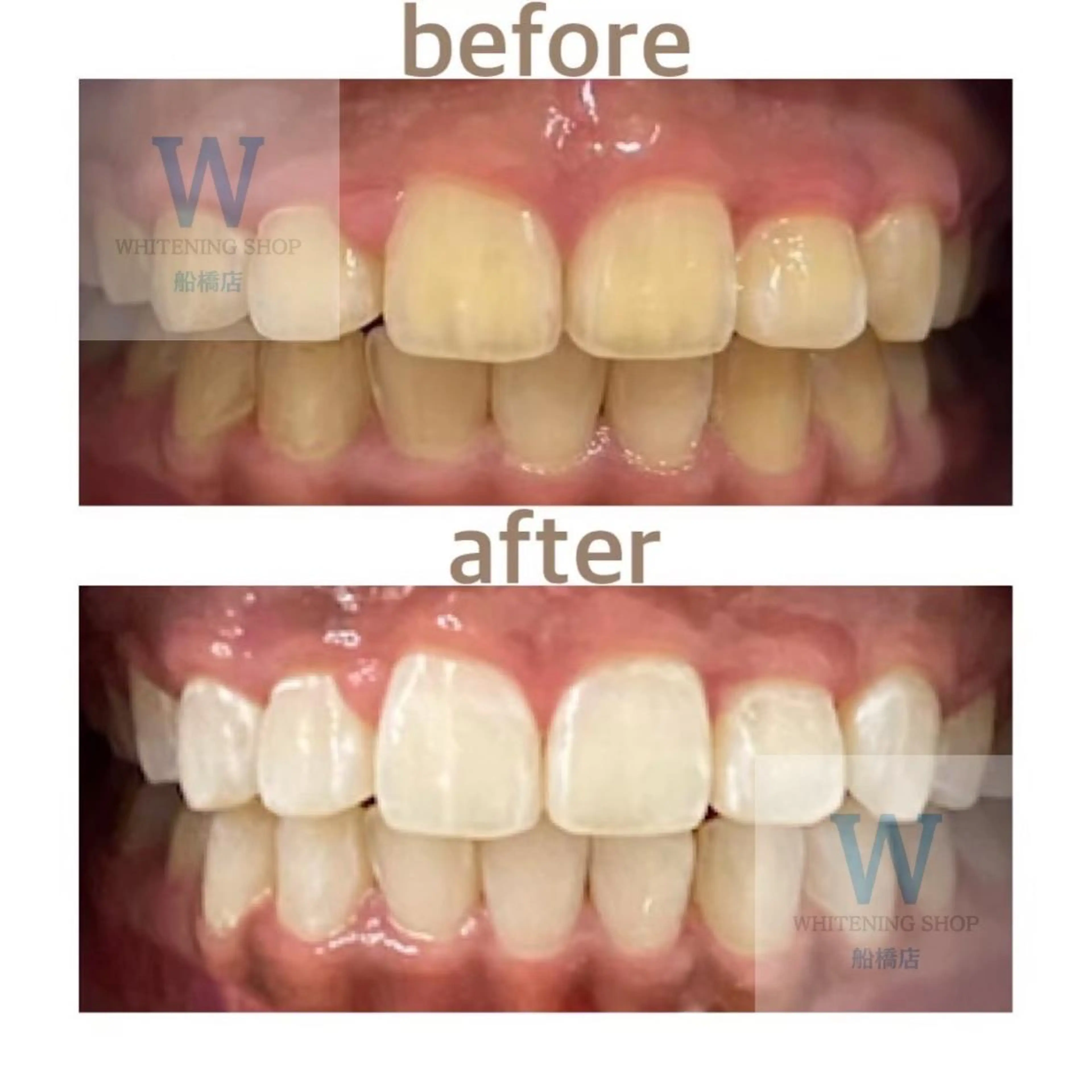 ホワイトニング ショップ船橋2号店のエステ・リラクイメージ