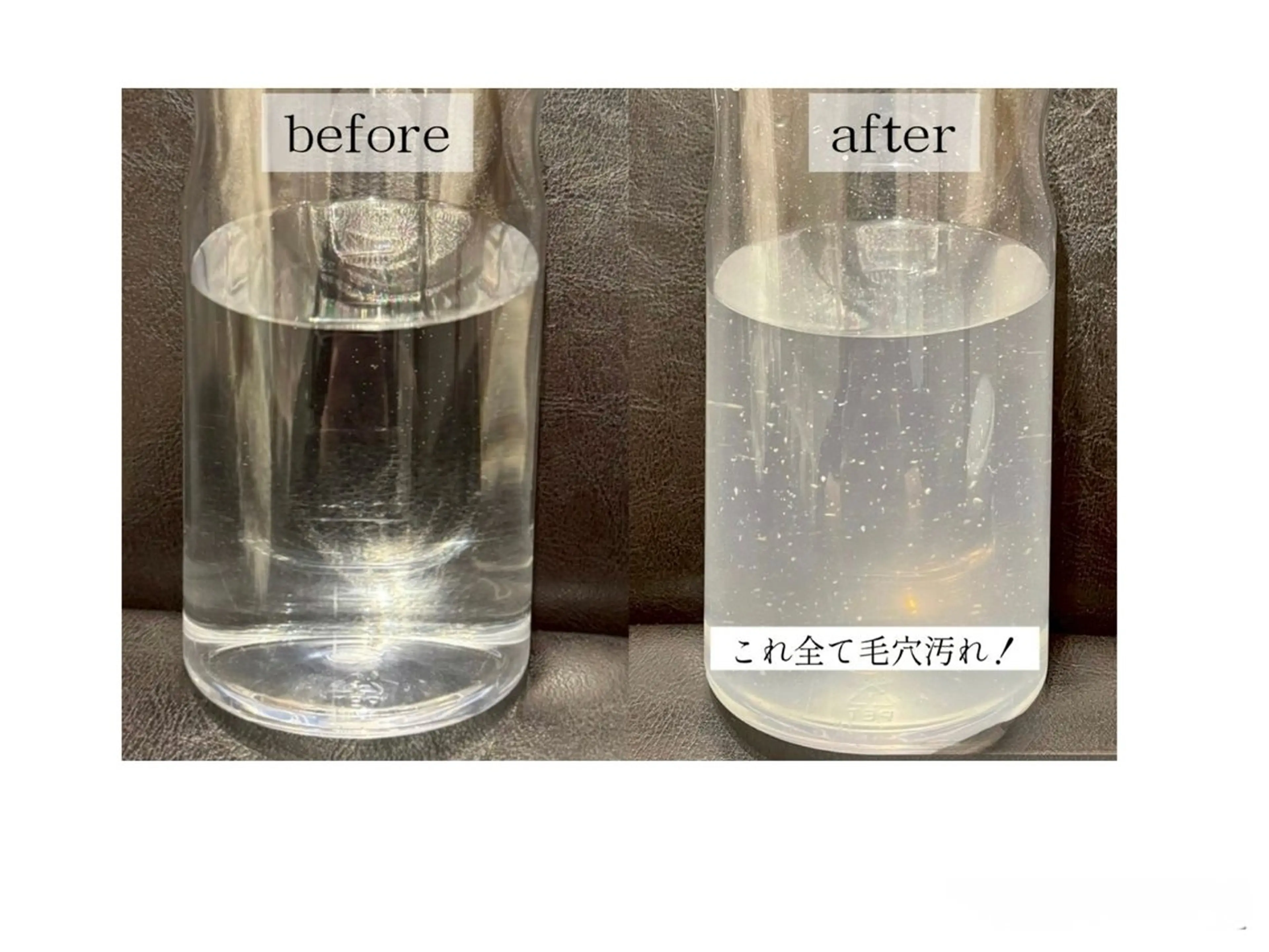 【学割U24】毛穴黒ずみ・ザラつき改善👃毛穴水流洗浄フェイシャル🚿イオン導入+パック付きの写真