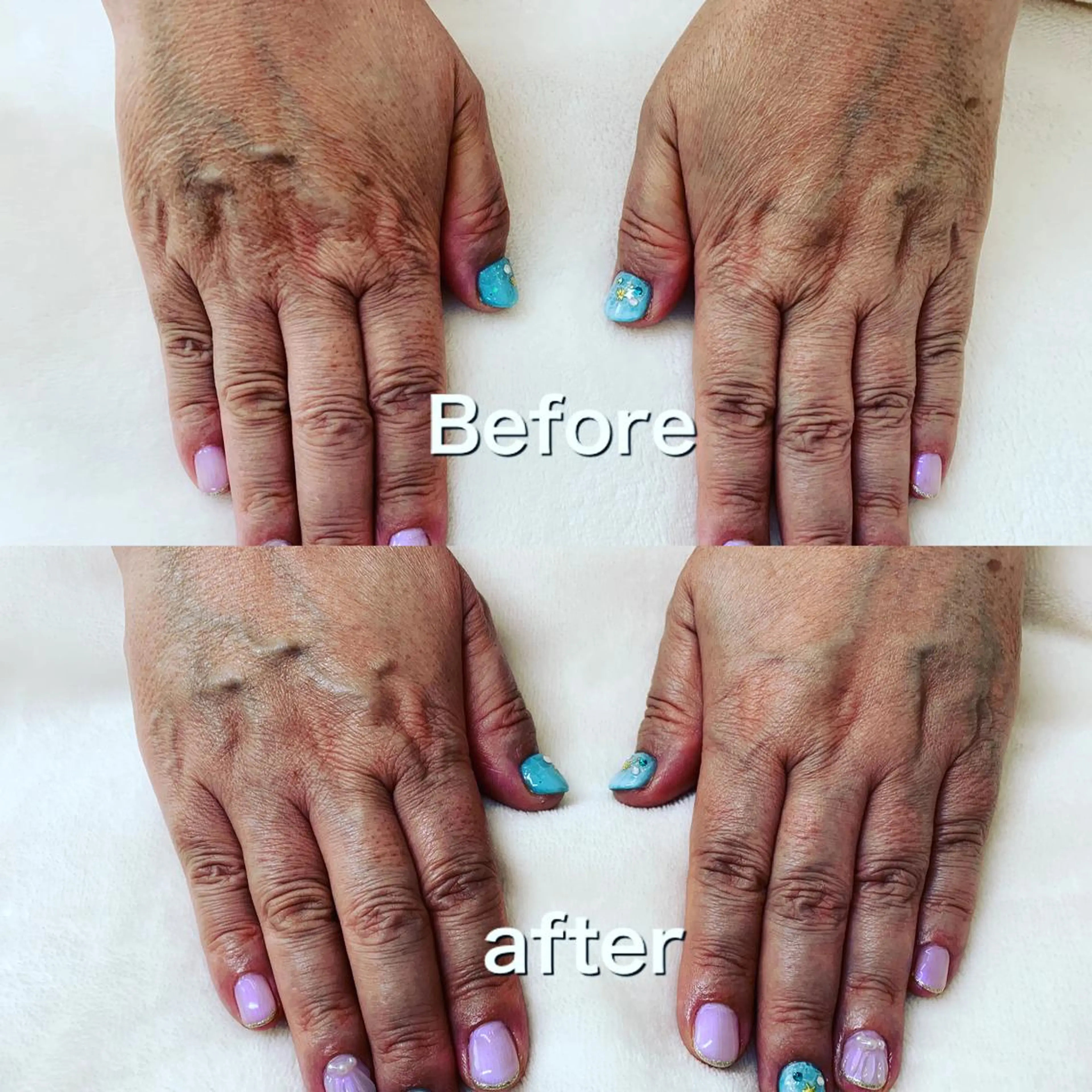 ネイル orchid ♡オーキッドのネイルデザイン