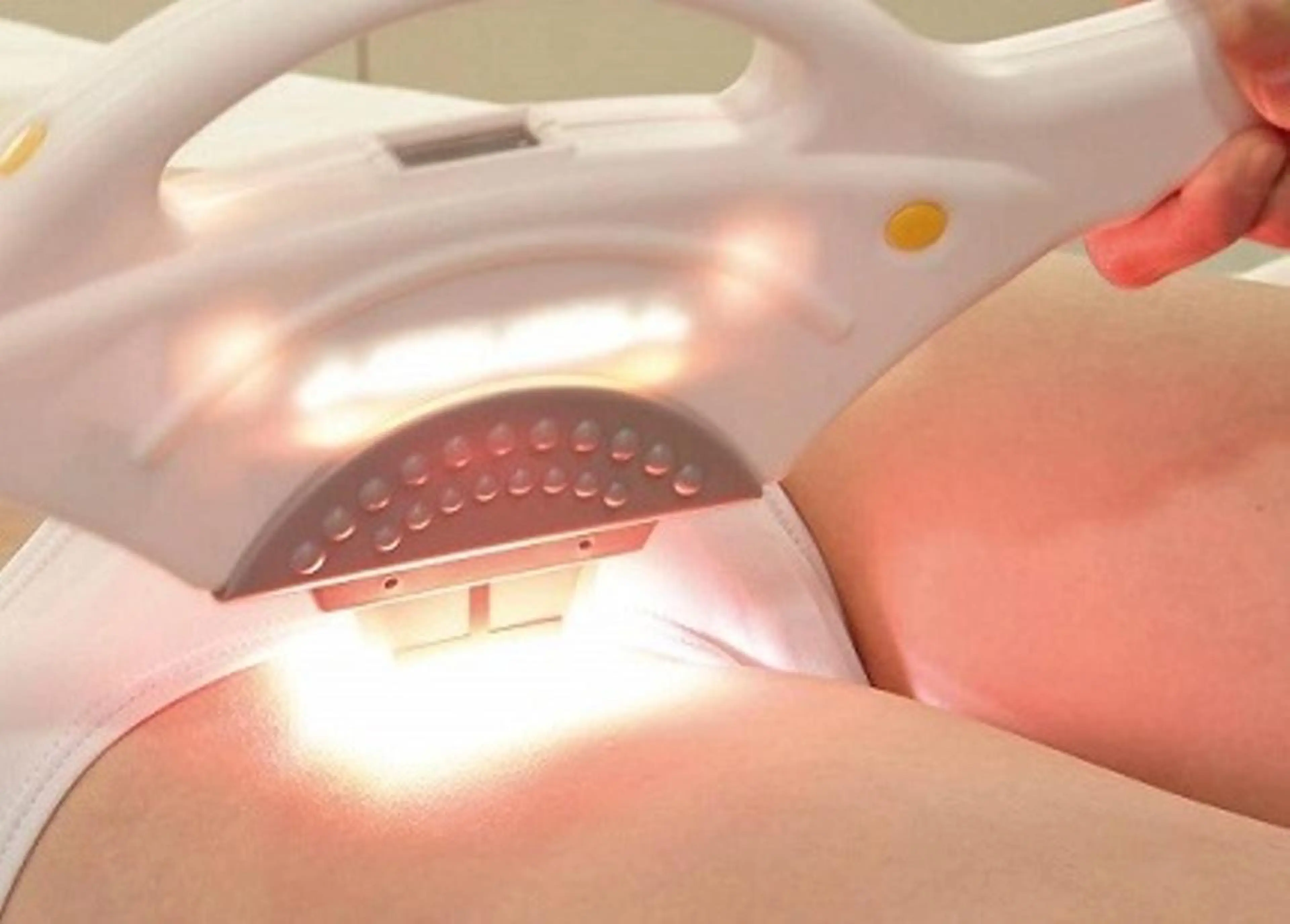 【美容VIO脱毛】エステ以上の圧倒的な抜けと美肌！毛の復活も無く粘膜まで脱毛の写真