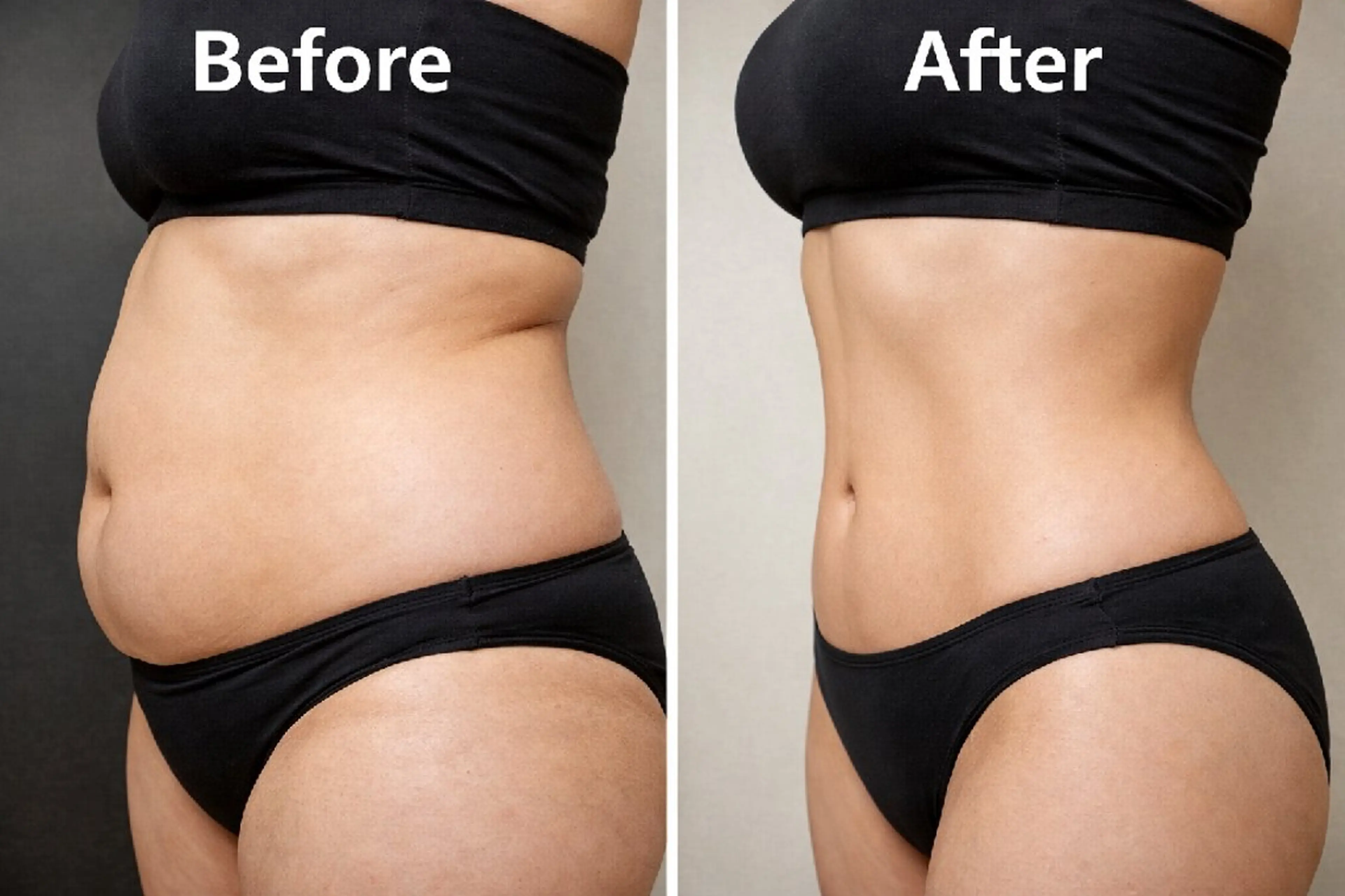 モデル痩身コース90分の写真