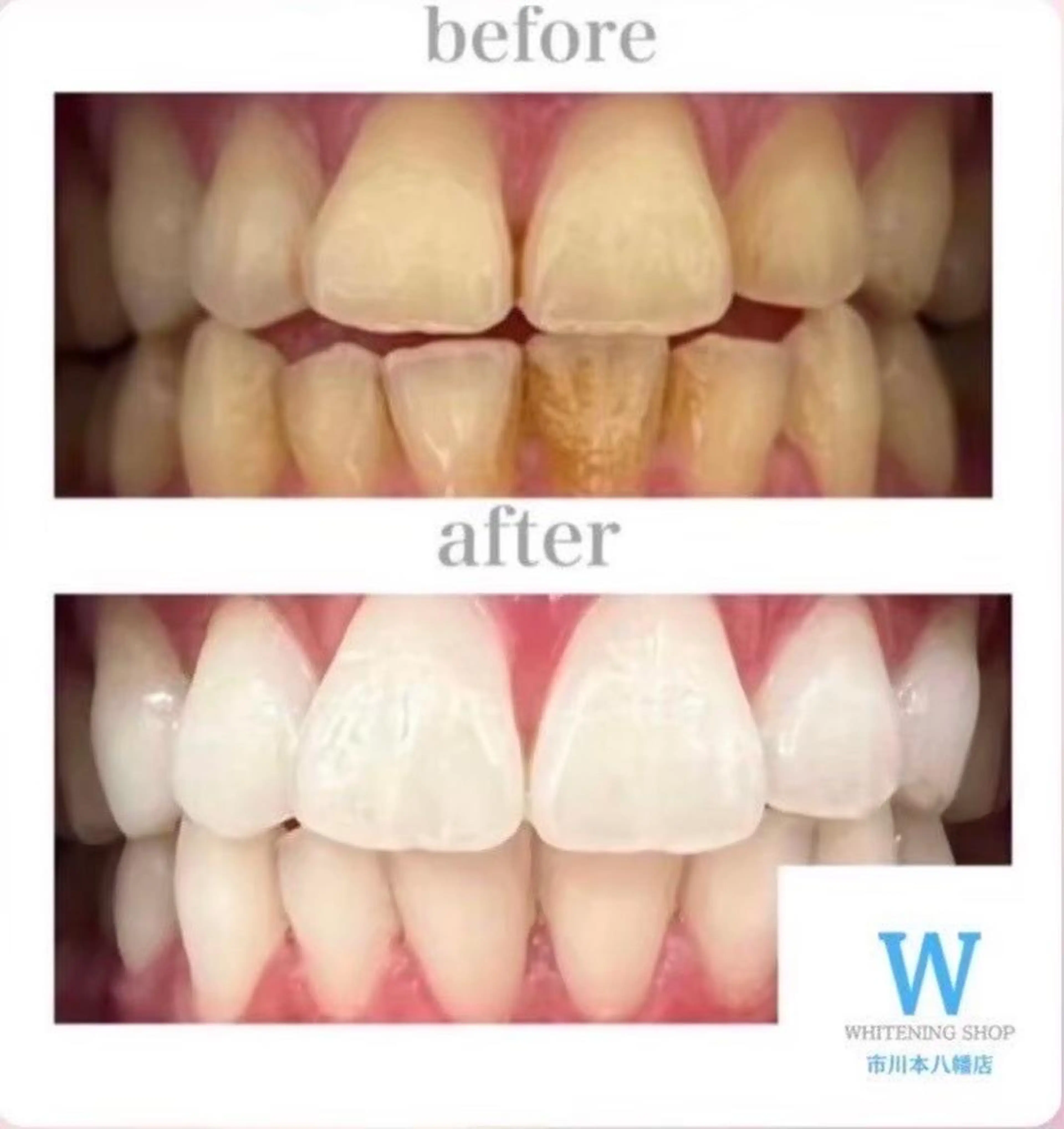 ホワイトニング ショップ本八幡店のエステ・リラクイメージ