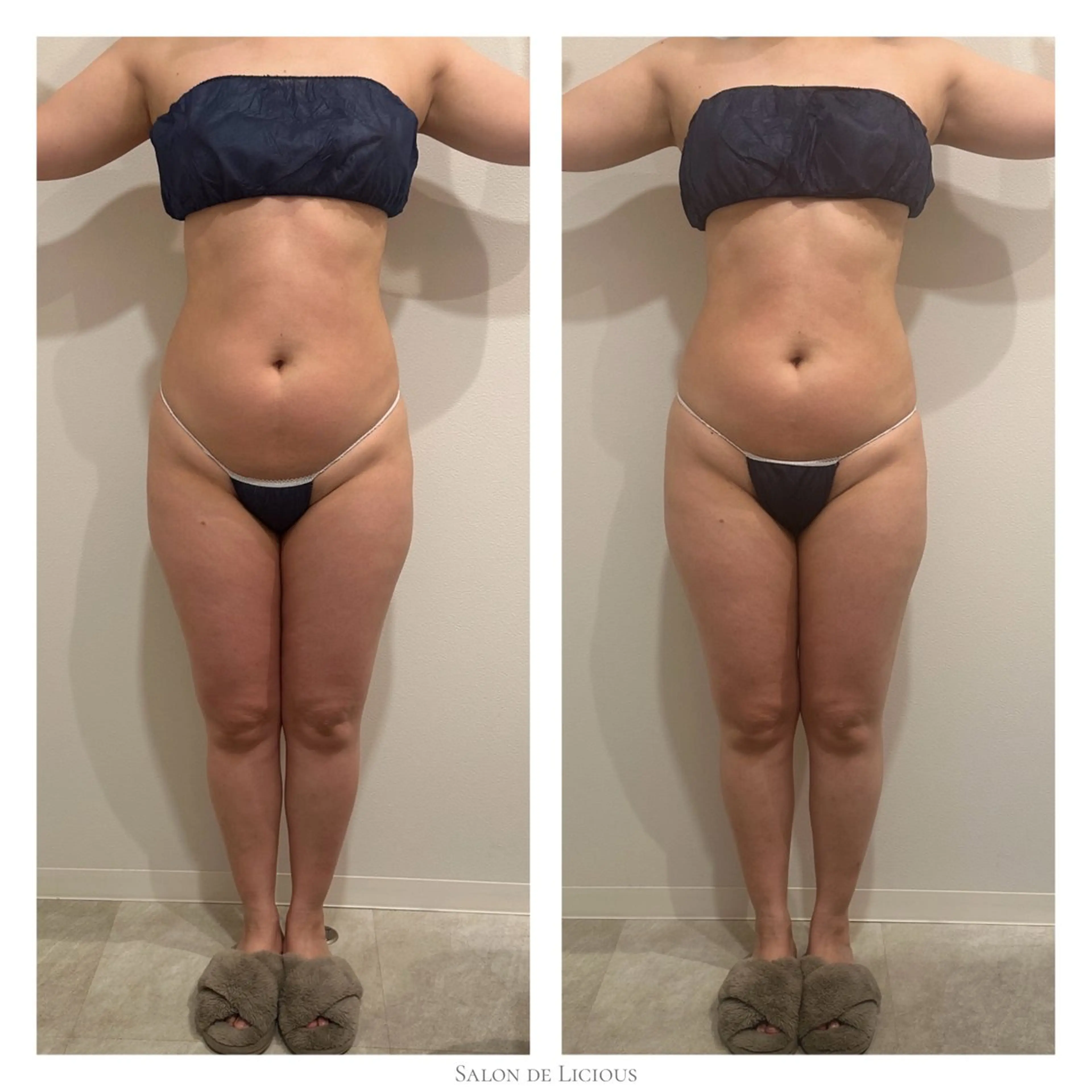 エステ 桜新町 Sakurakoの眉毛・アイブロウイメージ