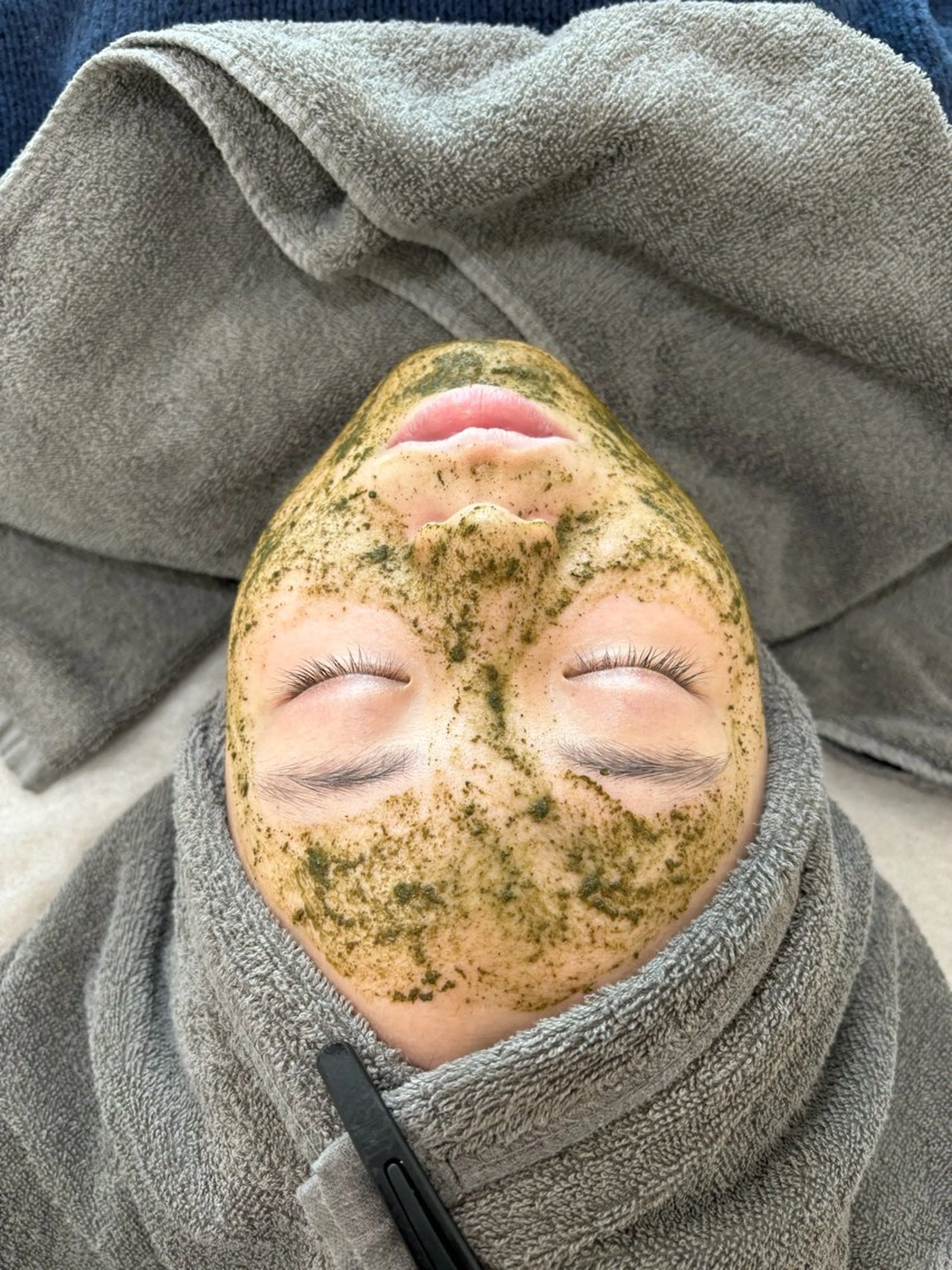 エステ 【foi】 natsumi🌼のその他イメージ