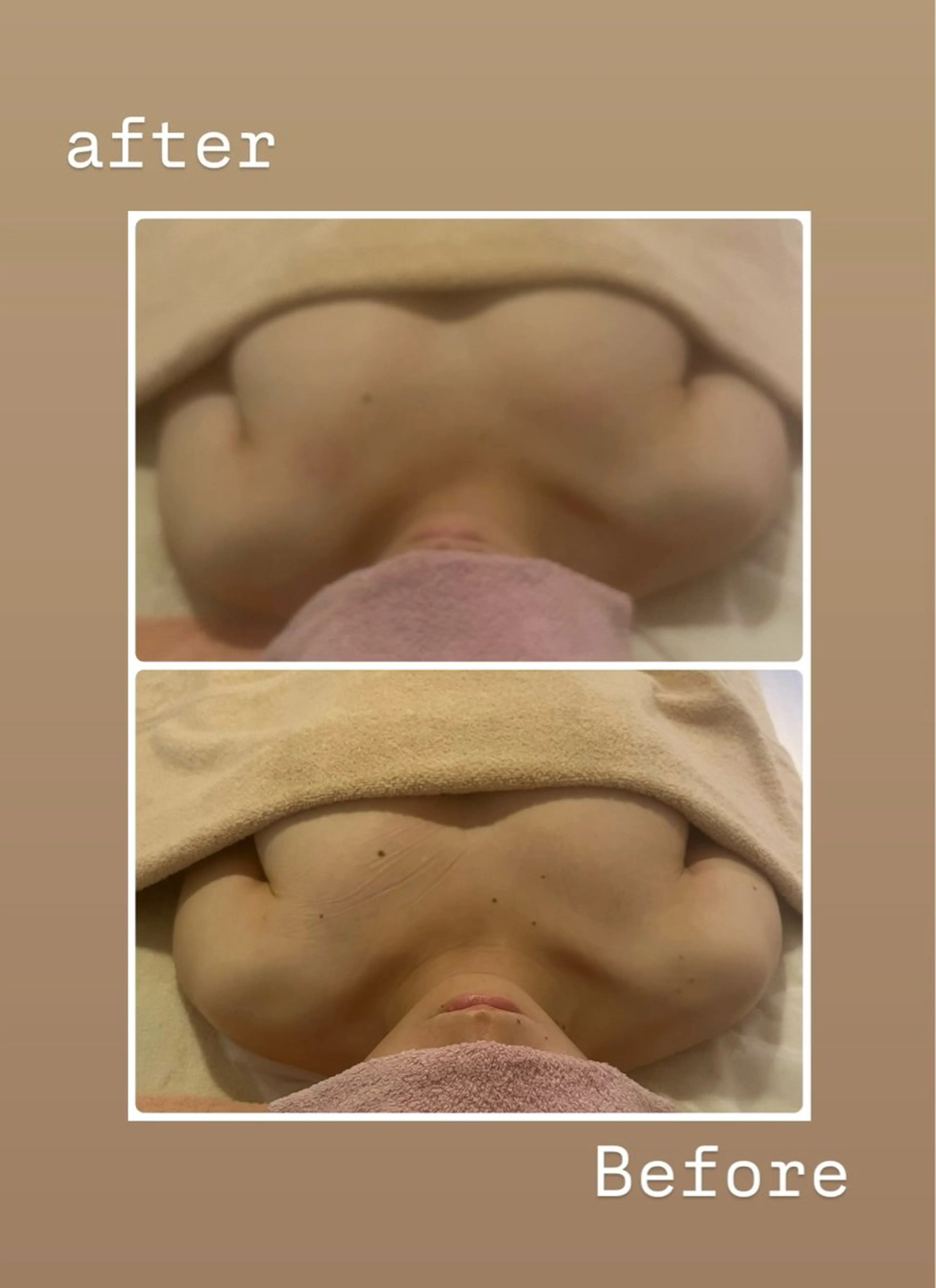 エステ リラク 女性ホルモン 専門サロン・ビオナスのエステ・リラクイメージ