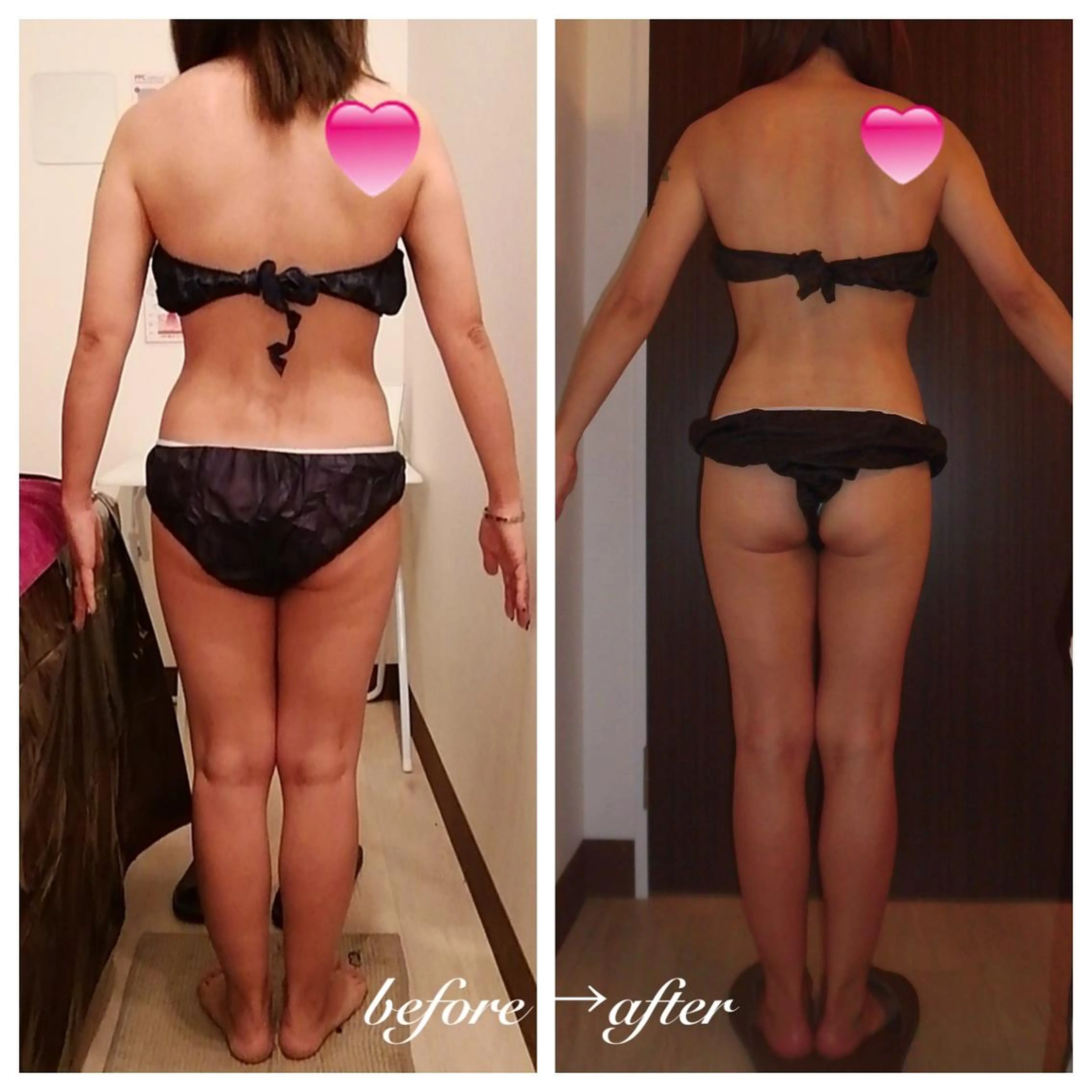 痩身・小顔・脱毛 グレイスボディのエステ・リラクイメージ