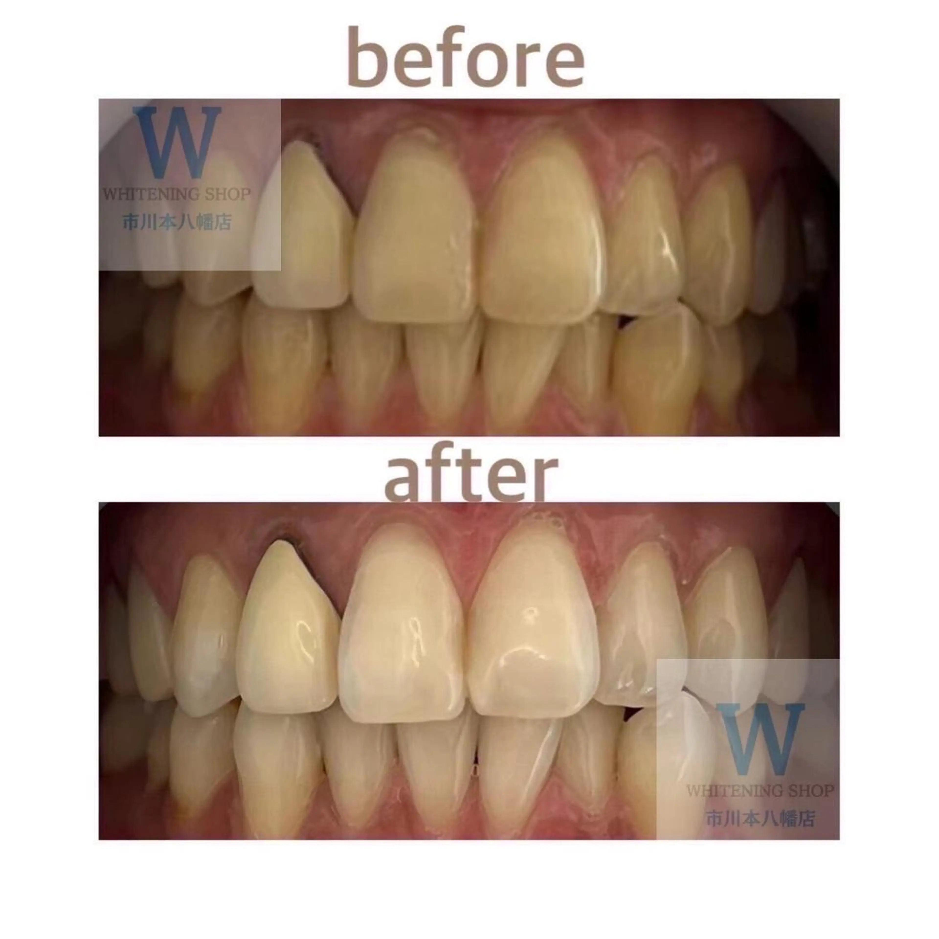 ホワイトニング ショップ本八幡店のエステ・リラクイメージ