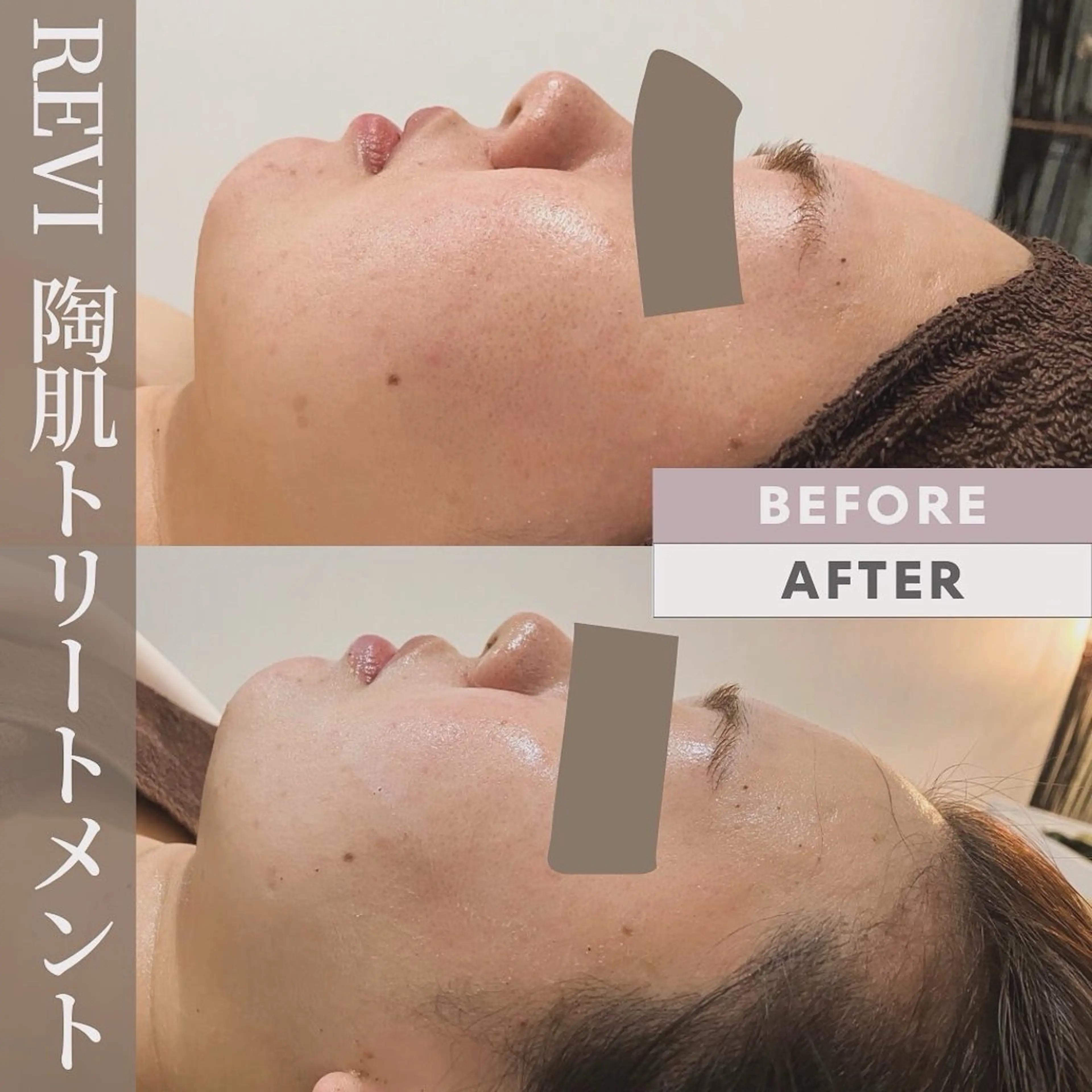 エステ リラク Salon💫 Lino'a柏店のエステ・リラクイメージ