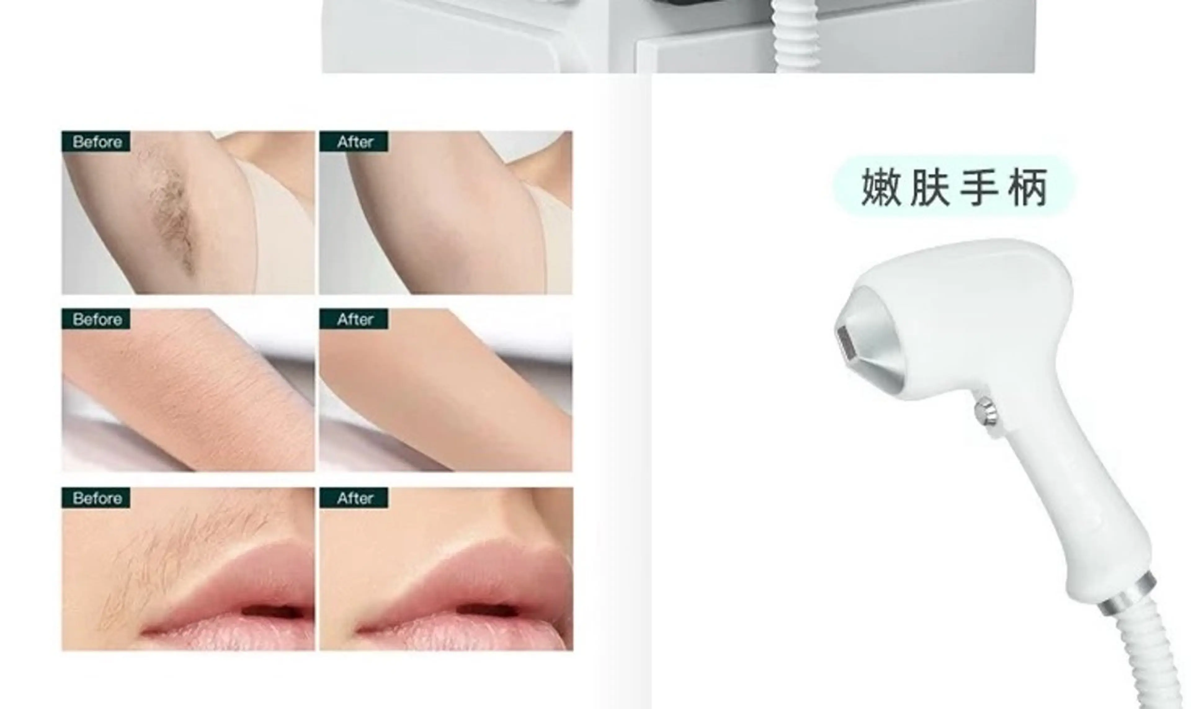 全身脱毛(VIO無)¥5,980☆全身毛穴レス美肌!の写真