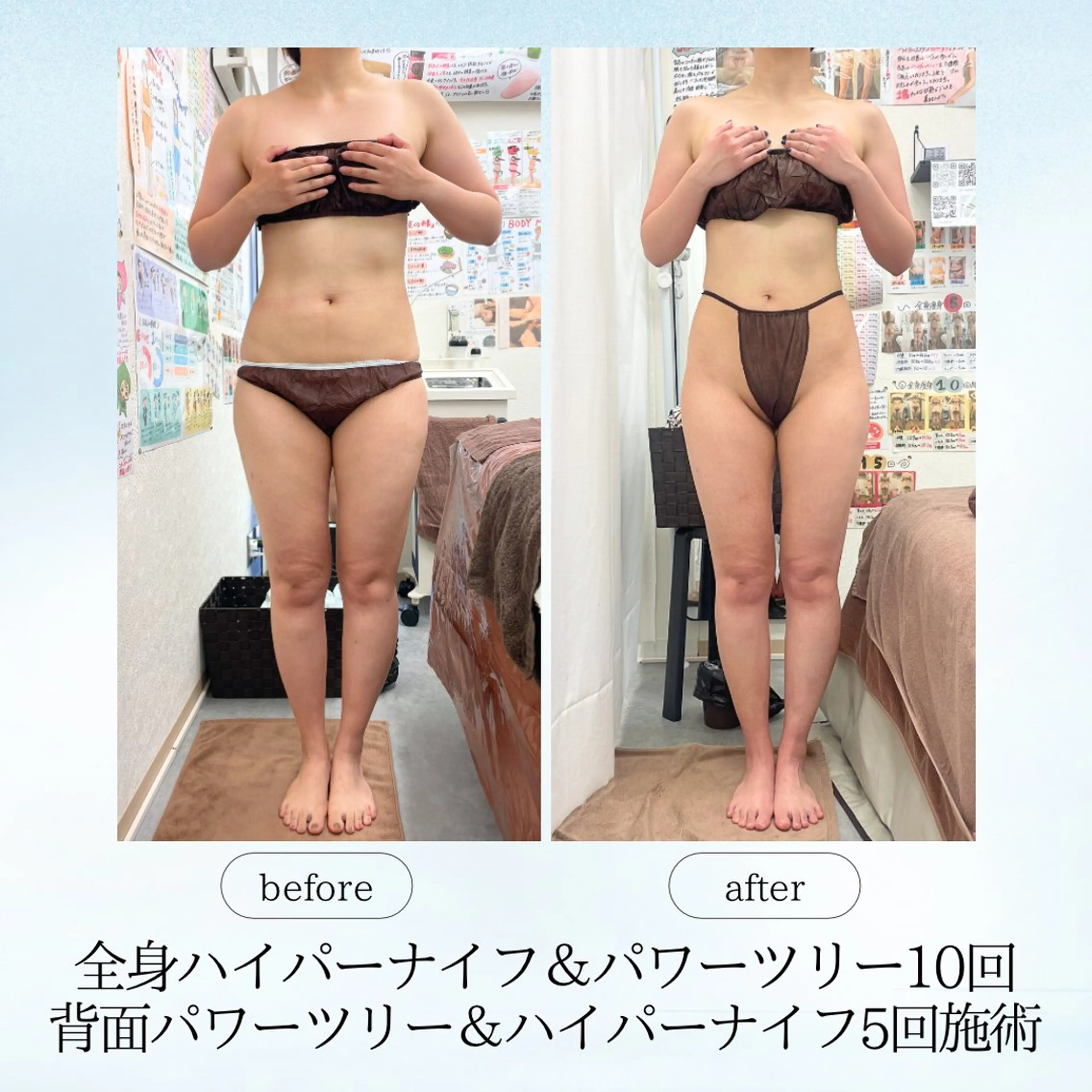 エステ リラク 《痩身、小顔専門店》 エスプレッソのエステ・リラクイメージ