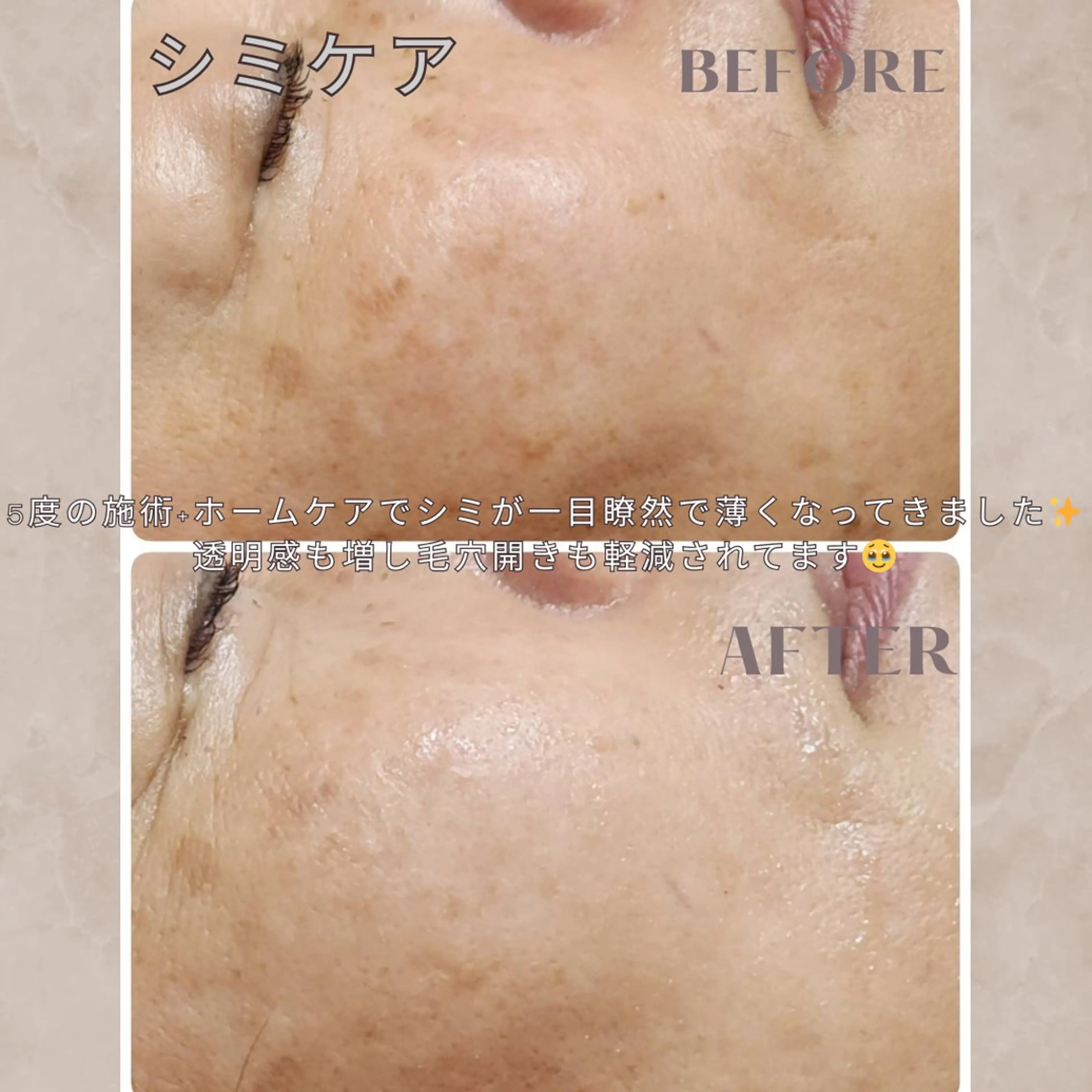 大橋 唯のエステ・リラクイメージ