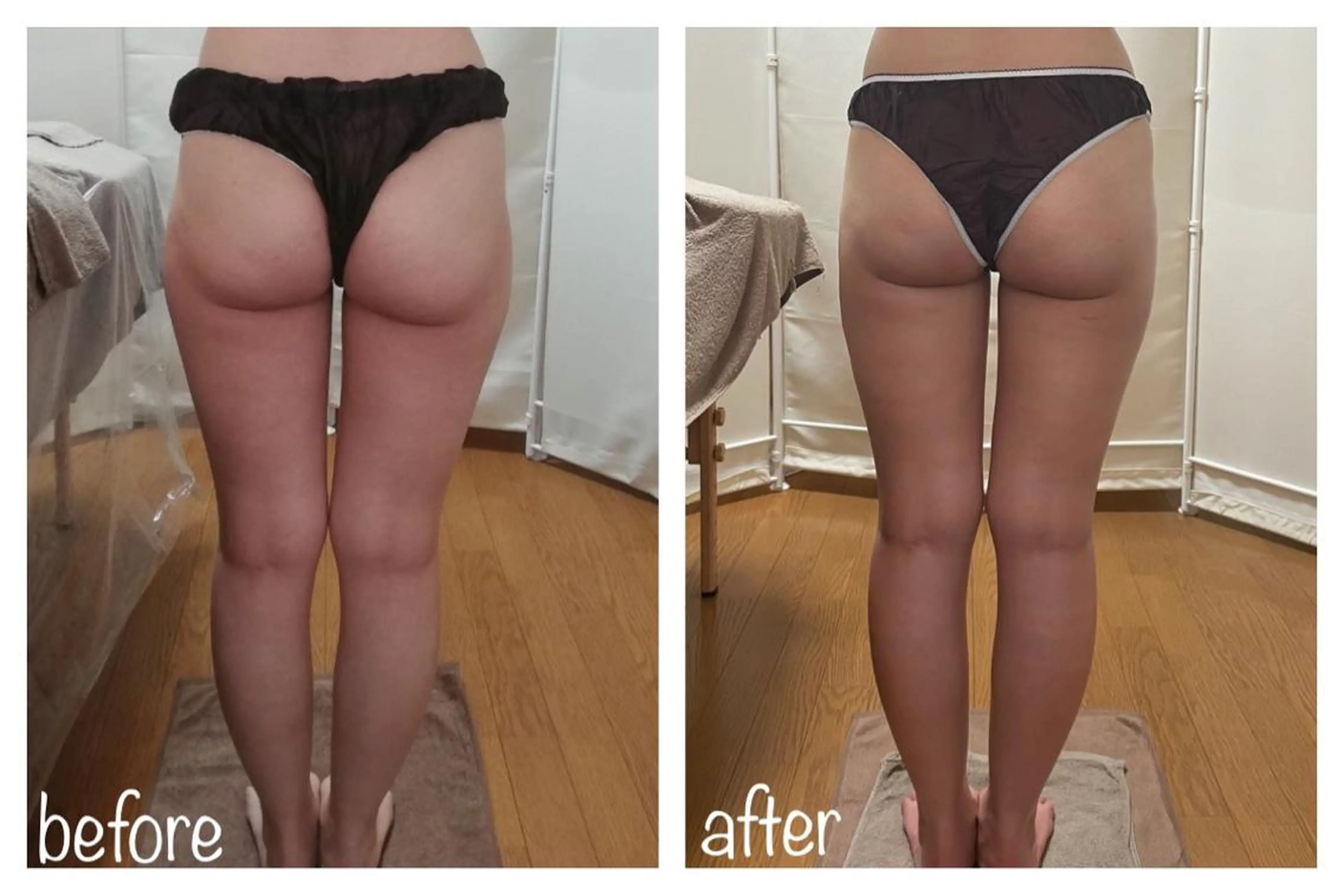 《本気痩せ×疲労改善 》  BILOOPのエステ・リラクイメージ