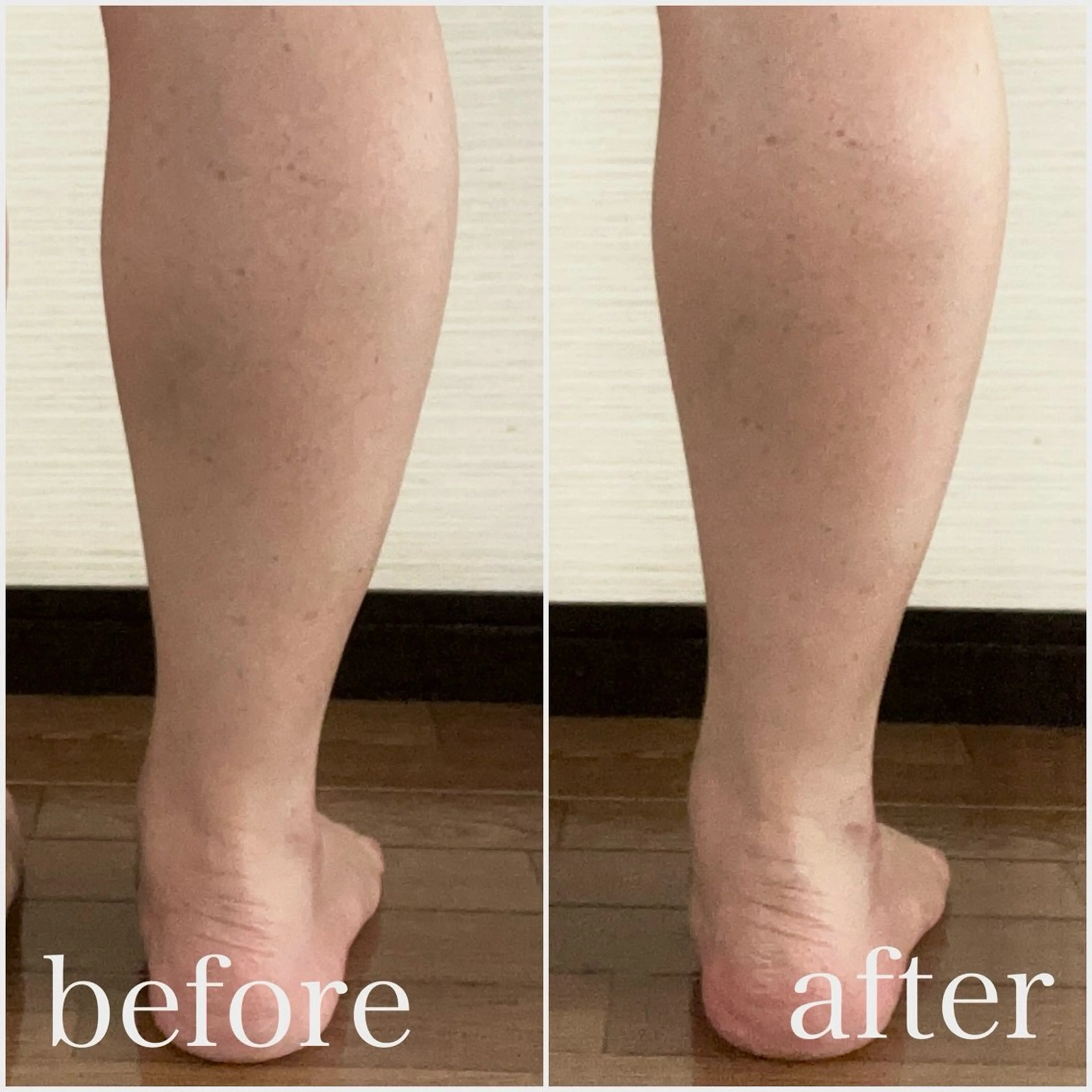 エステ リラク PIUMA 筋膜リリース・リンパのエステ・リラクイメージ