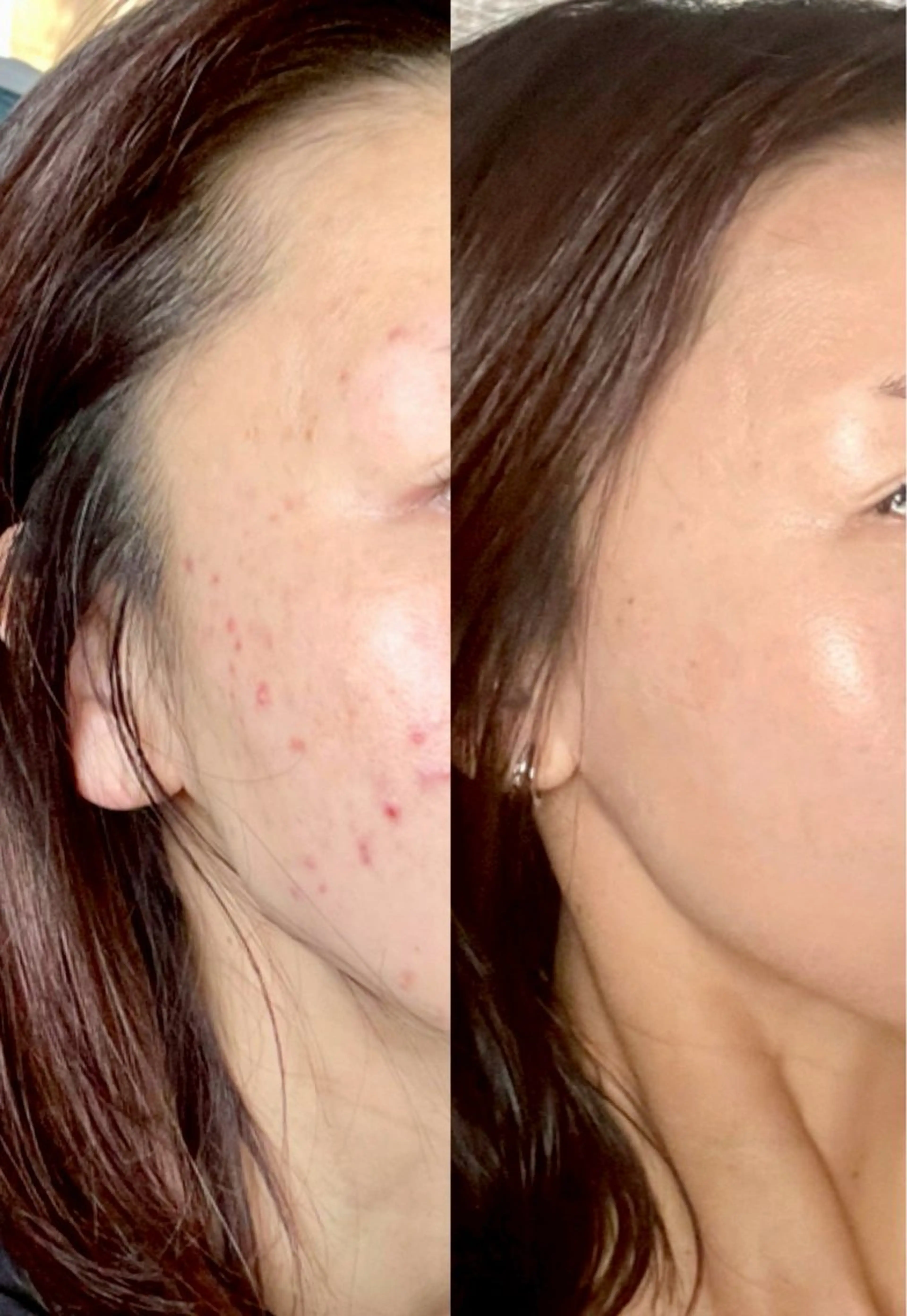 毛穴、肌質ケア専門 グランビューティのエステ・リラクイメージ