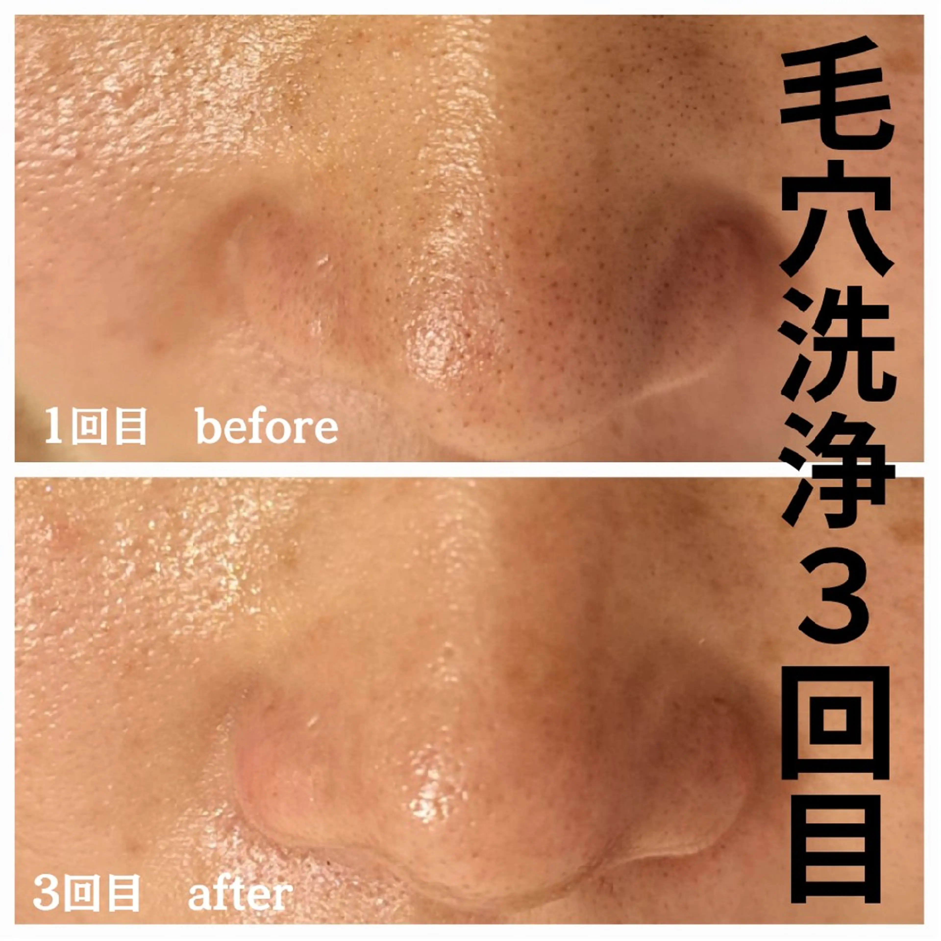 エステ フェイシャル専門サロ ン　ERINのエステ・リラクイメージ