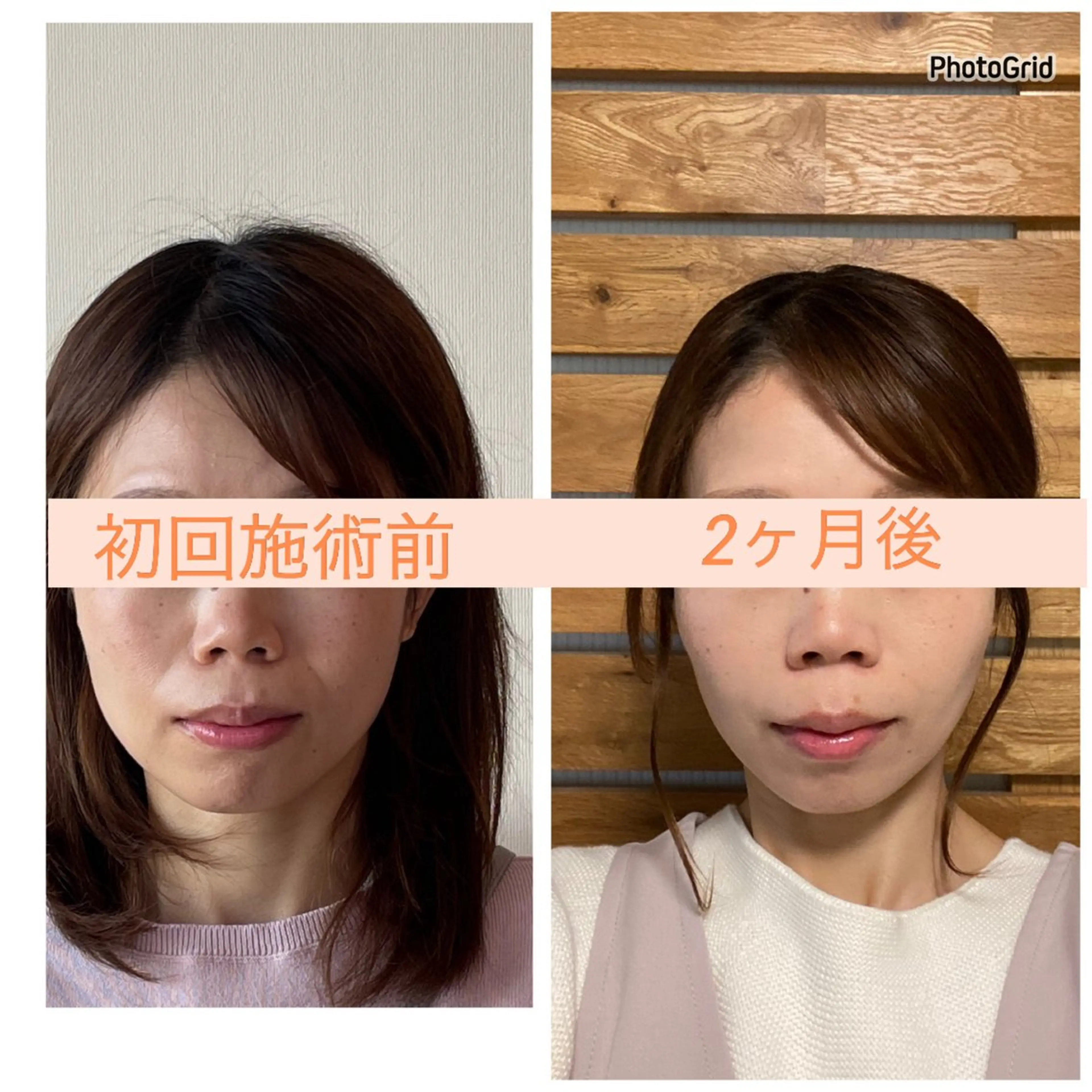 小顔矯正サロン リフェイスフサエのエステ・リラクイメージ