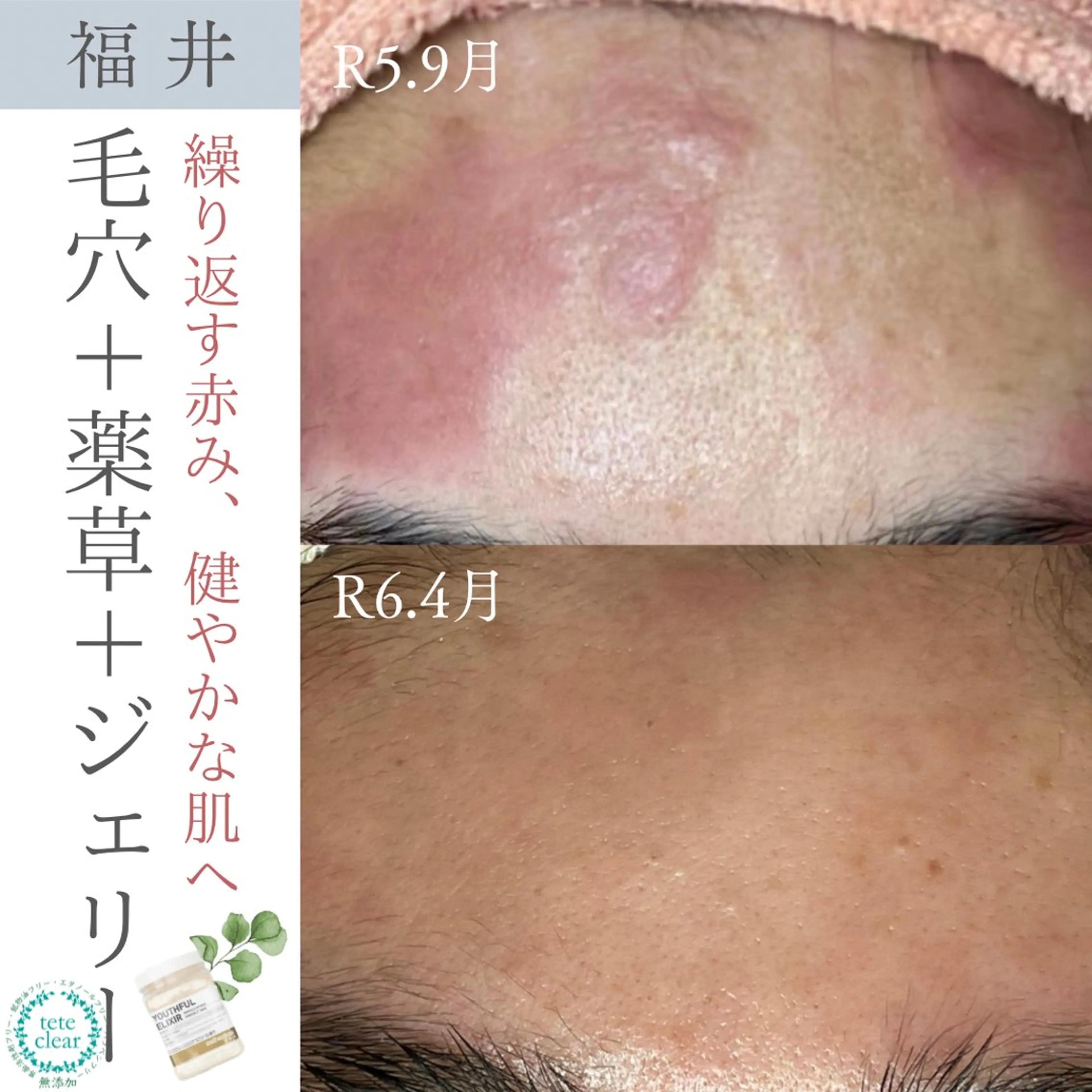 毛穴肌質ケアサロン Yourmeユアミーのエステ・リラクイメージ