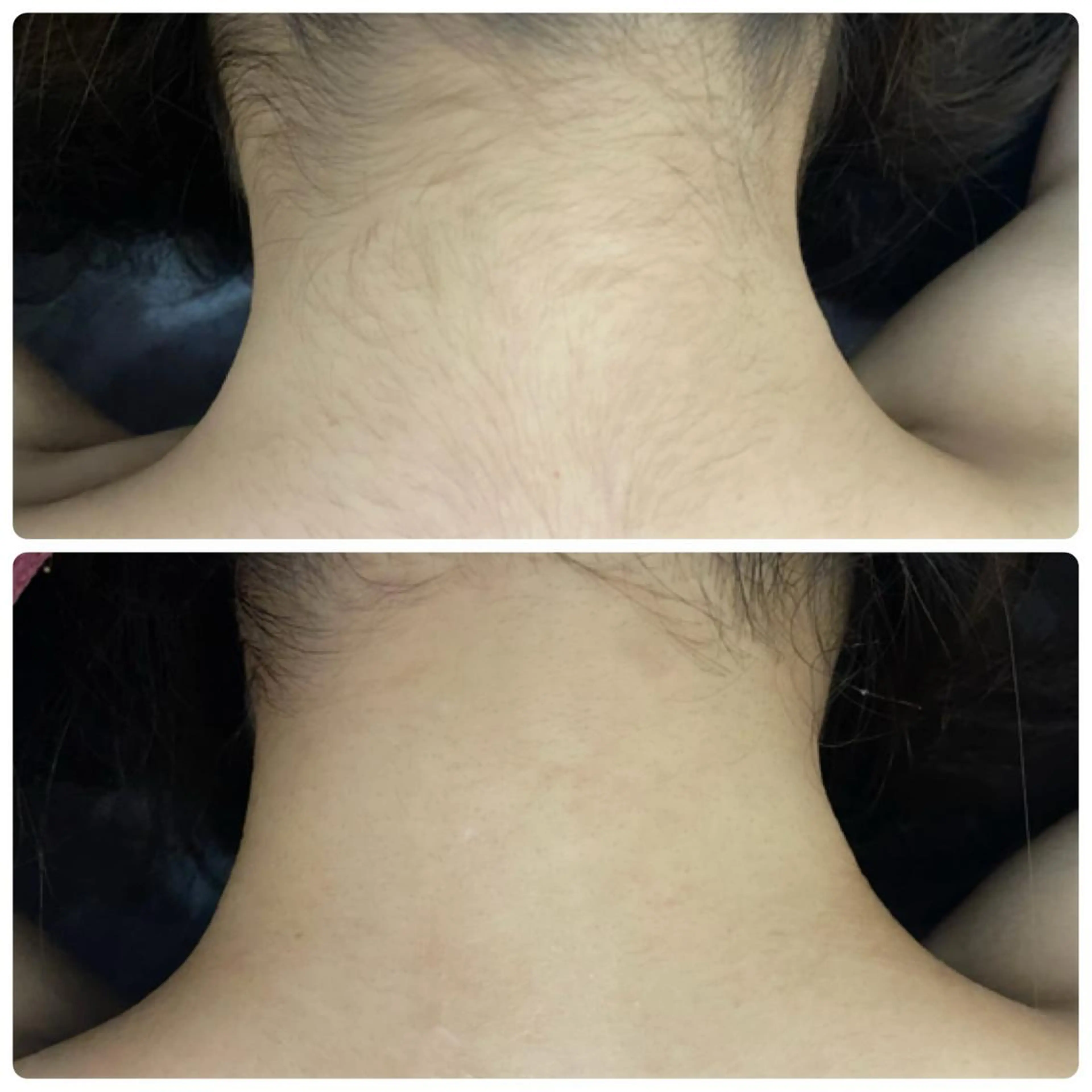 ビューティーサロン Aquaのエステ・リラクイメージ