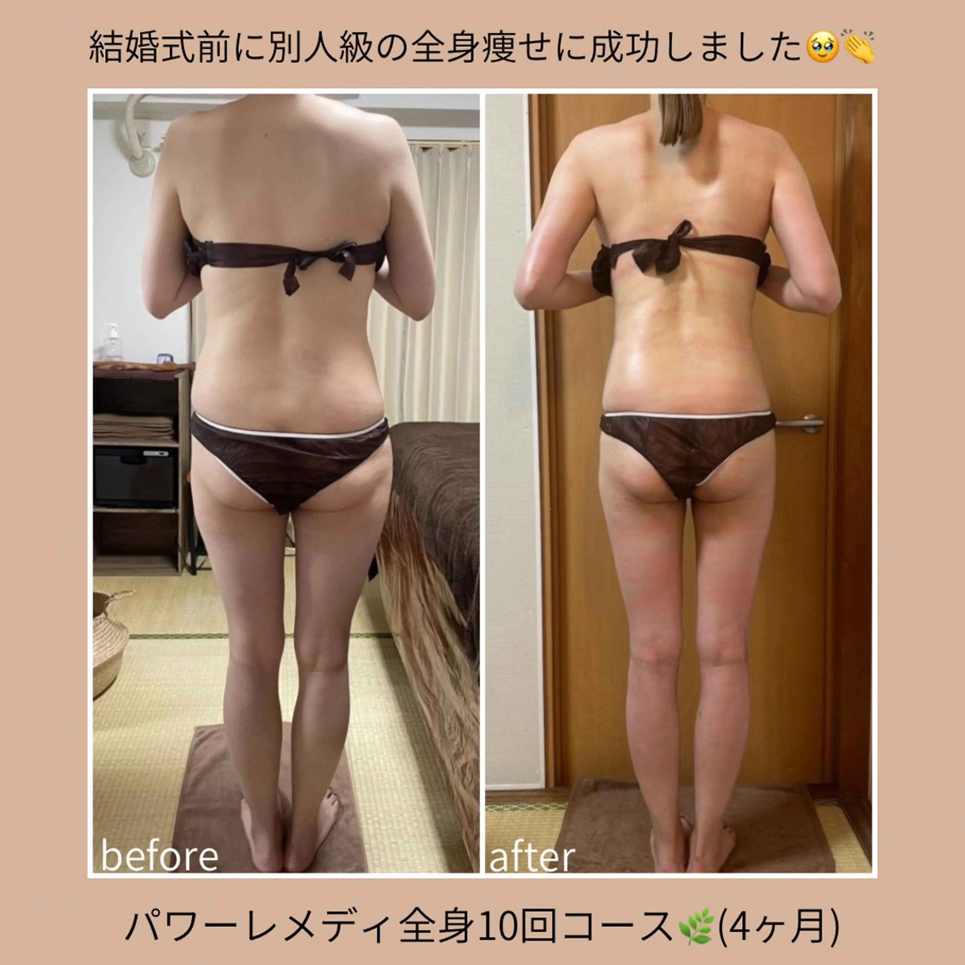 biloop所属・《本気痩せ×疲労改善 》 BILOOPのエステ・リラクイメージ