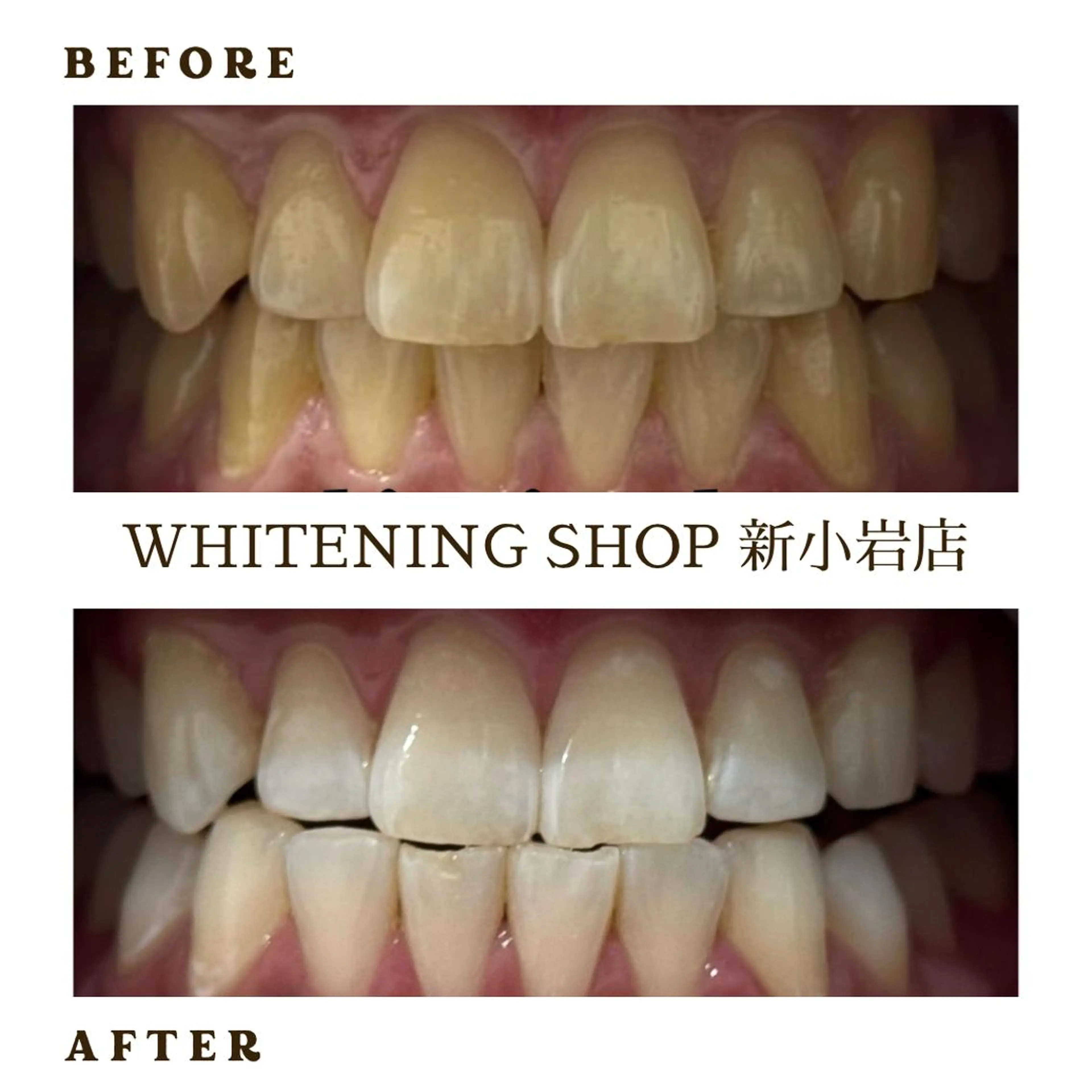 メンズ ホワイトニング ショップ新小岩店のその他イメージ