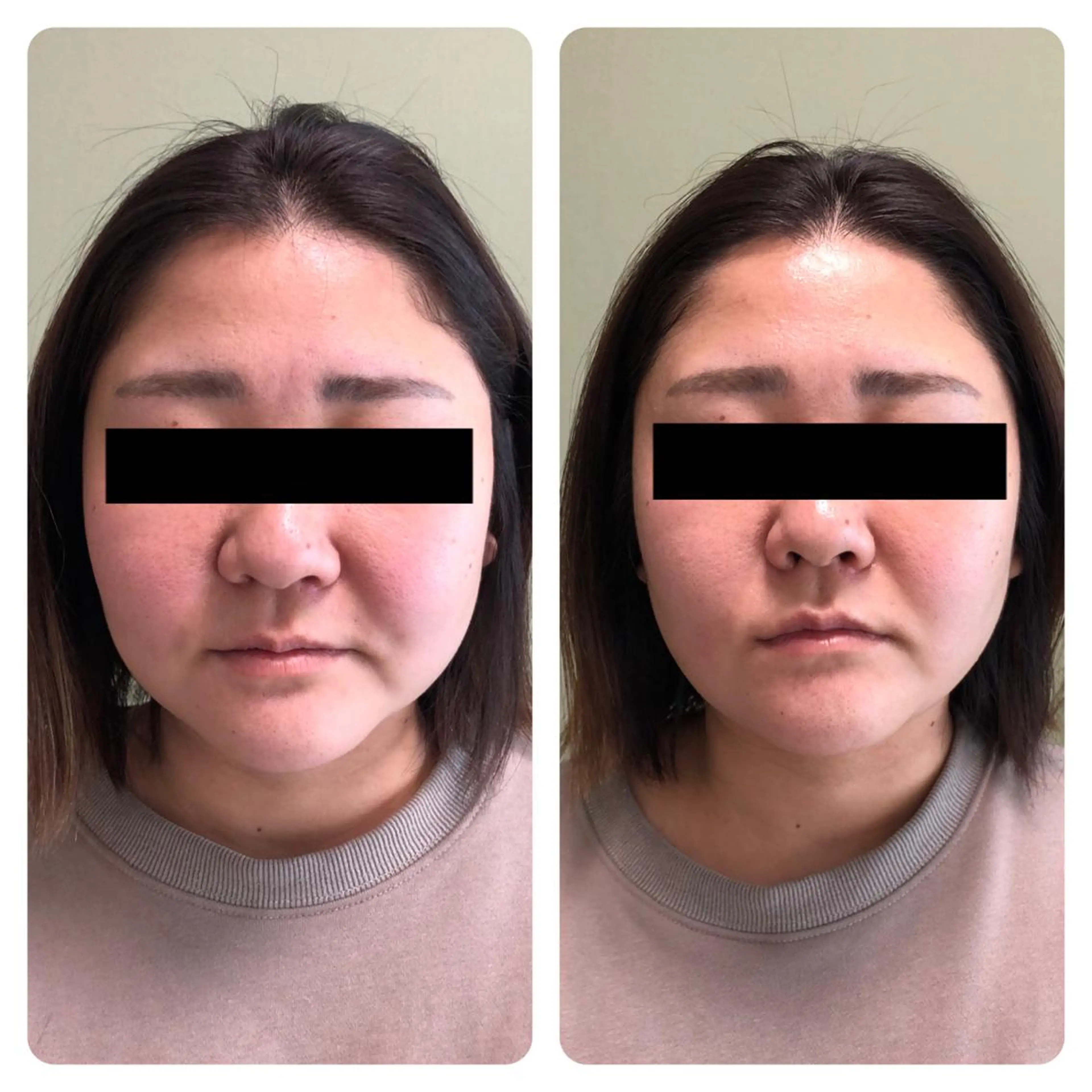 ミディアム カラー パーマ ヘアアレンジ メンズ キッズ ネイル アイブロウ 【ハーブ×毛穴洗浄】 THE MORE千葉のエステ・リラクイメージ