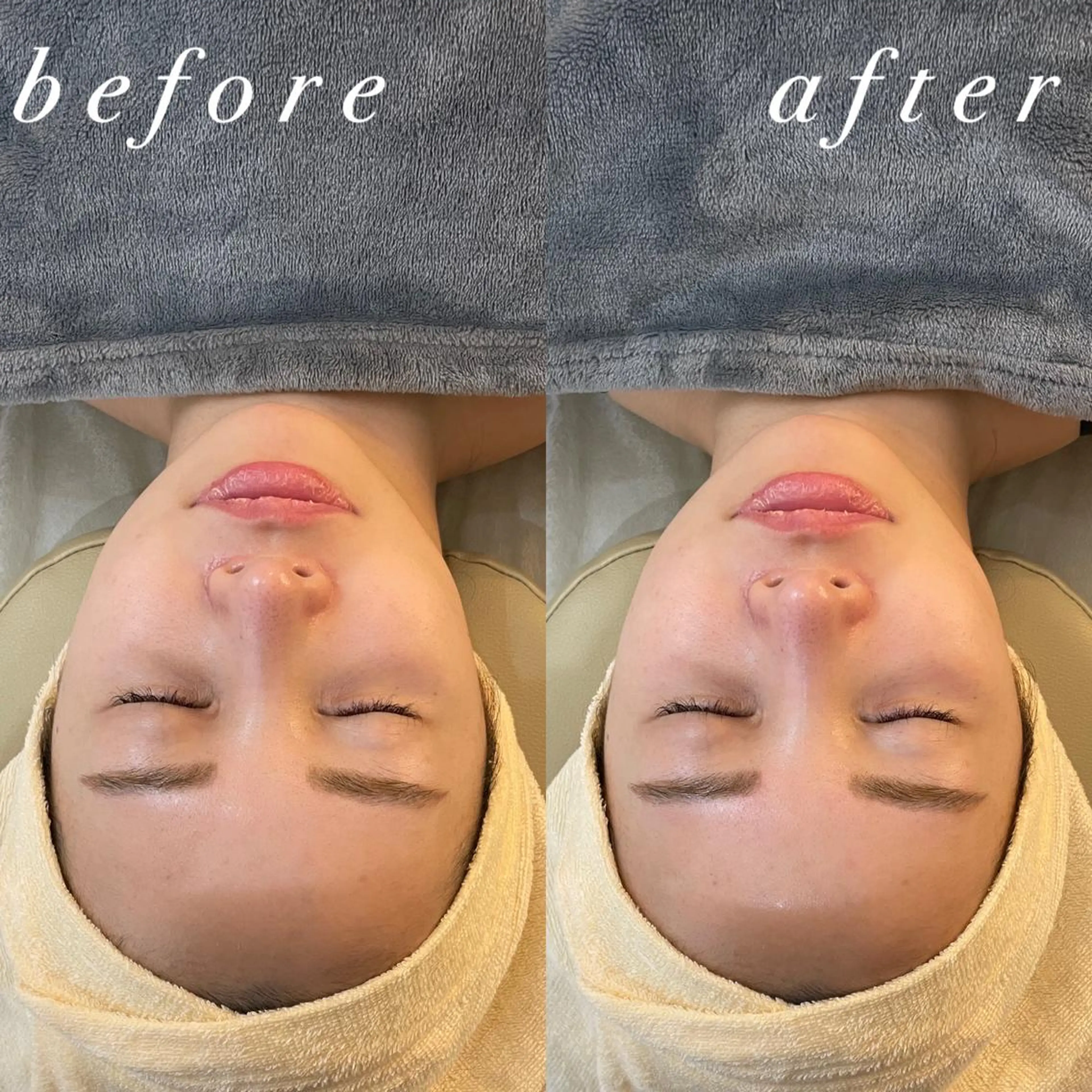 うなじ脱毛/美肌脱毛 LABELのエステ・リラクイメージ